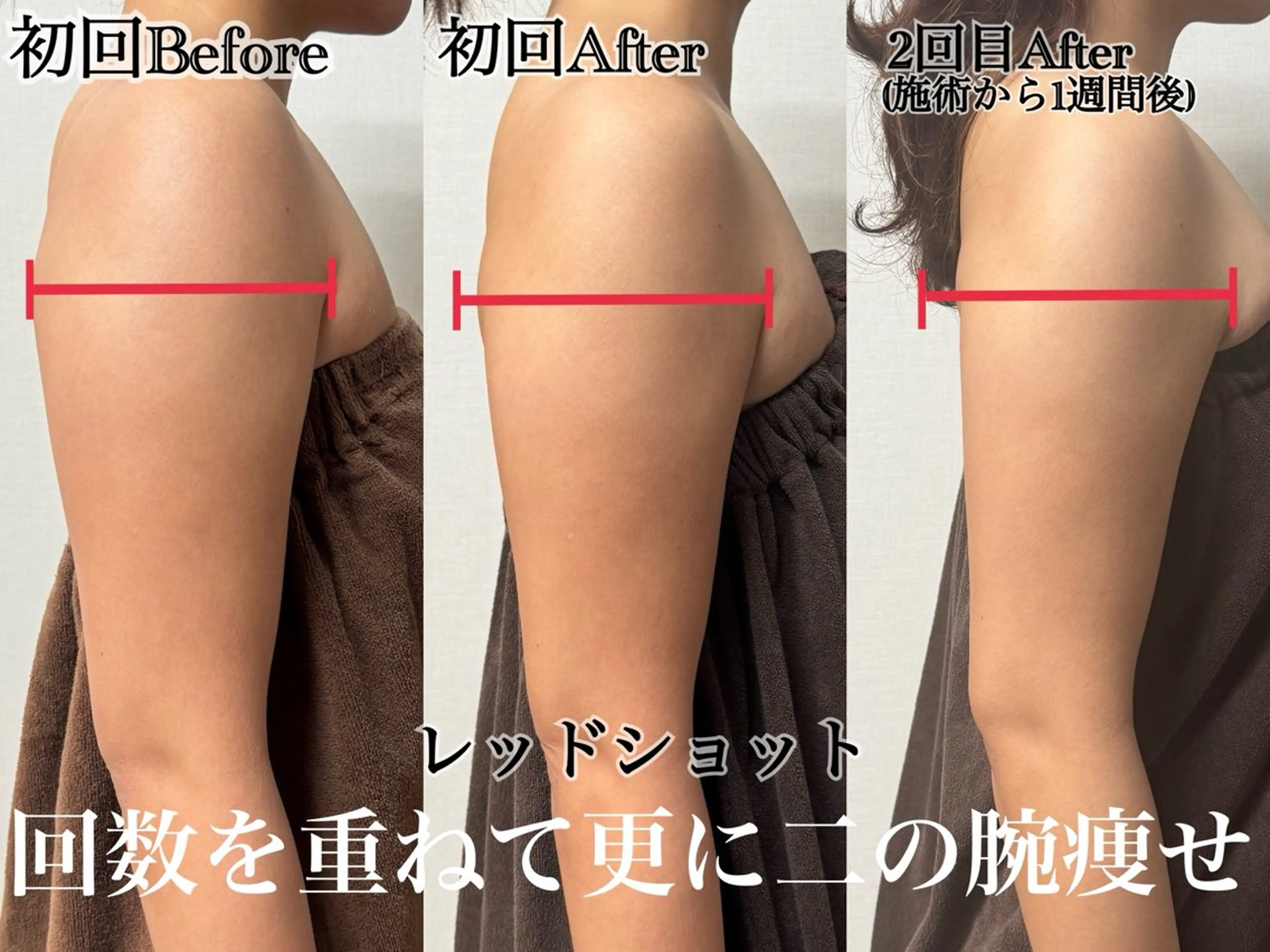 エステ 六本木脱毛andS 店長Sachiのエステ・リラクイメージ