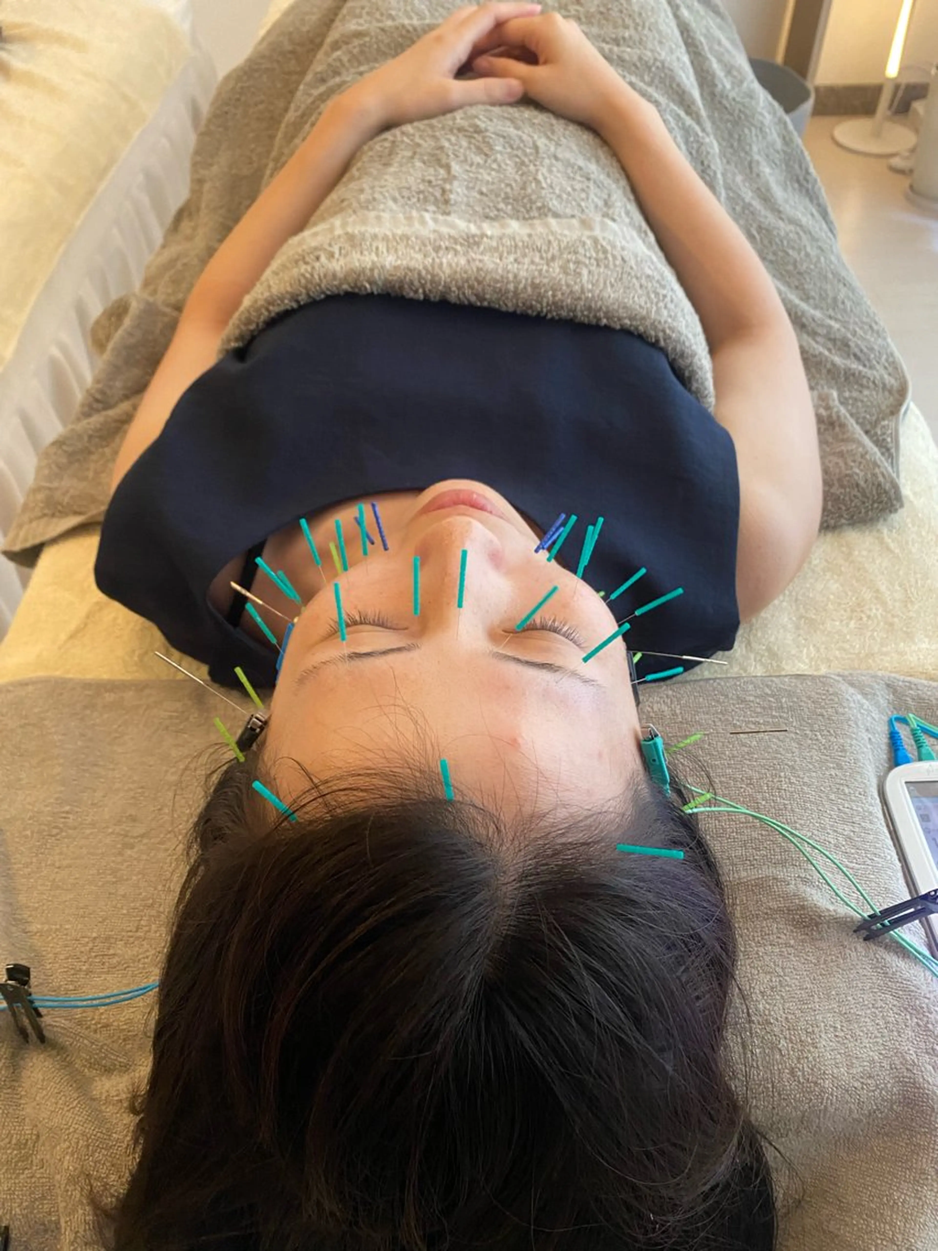 エステ リラク 鍼灸•マッサージサロンCalfa所属・《美肌･小顔》美容鍼 ＆マッサージ＊MEIのエステ・リラクイメージ