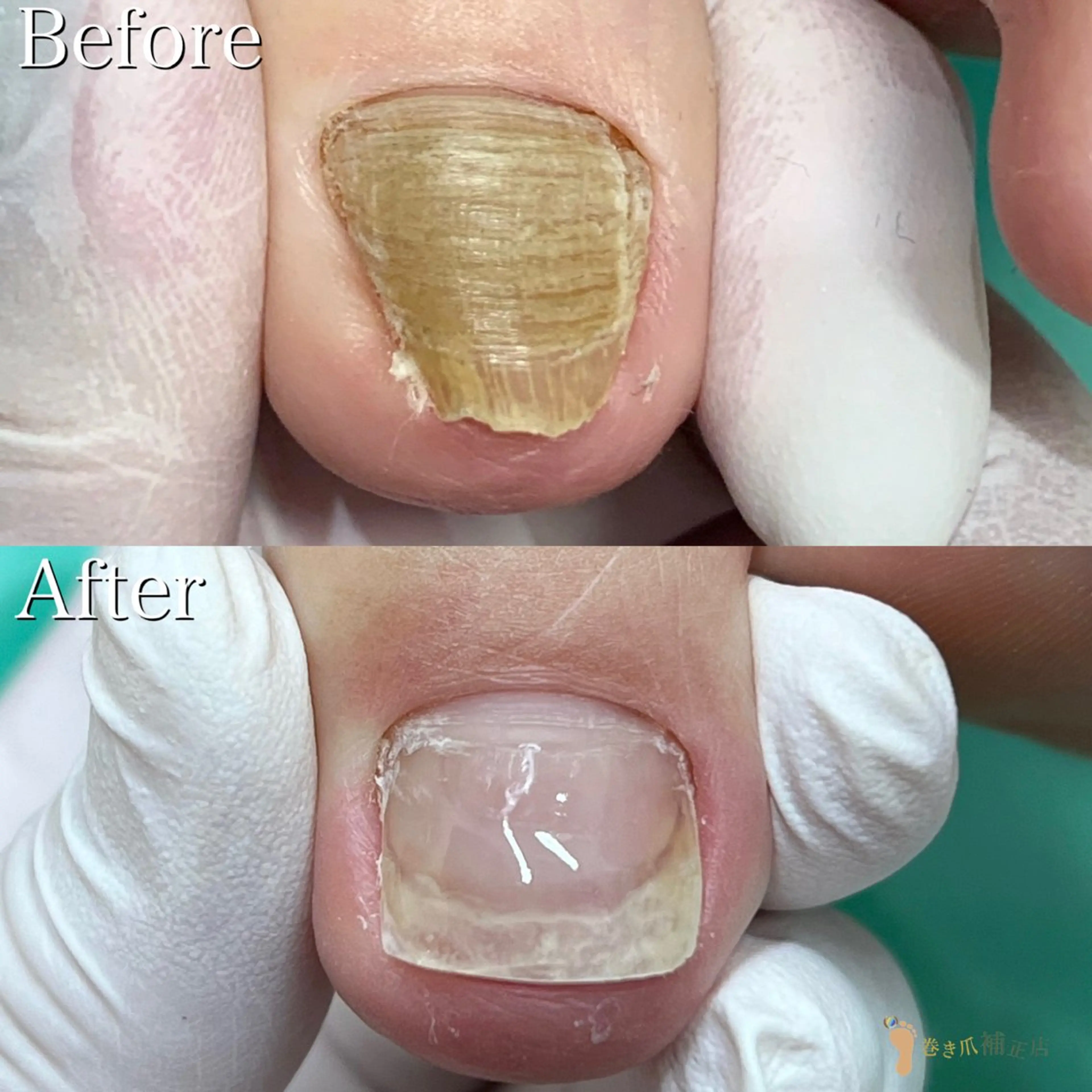 ネイル 東京巻き爪アカデミー所属・東京巻き爪 アカデミーのエステ・リラクイメージ