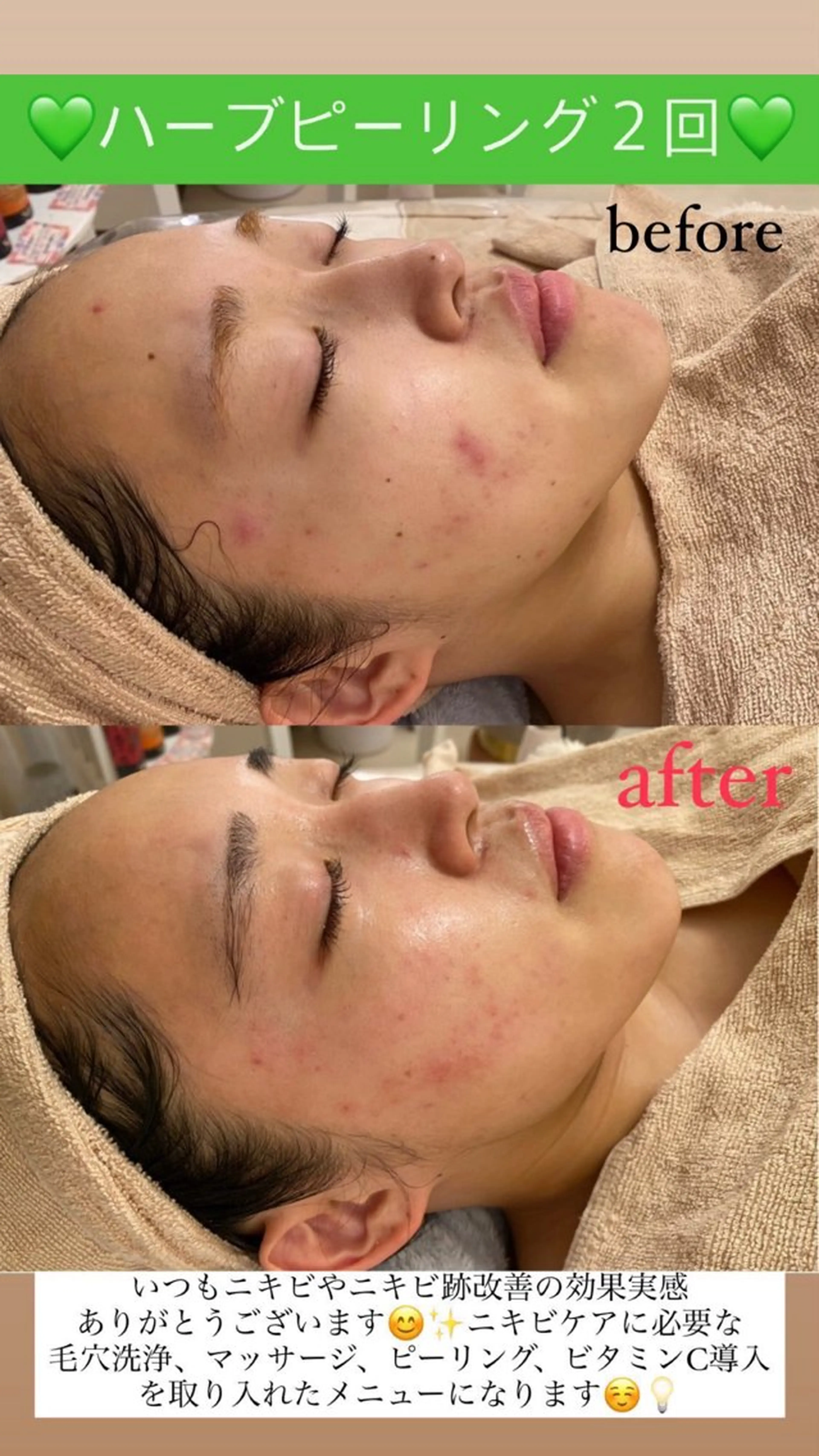 メンズ エステ Salon de Lino 御器所のエステ・リラクイメージ