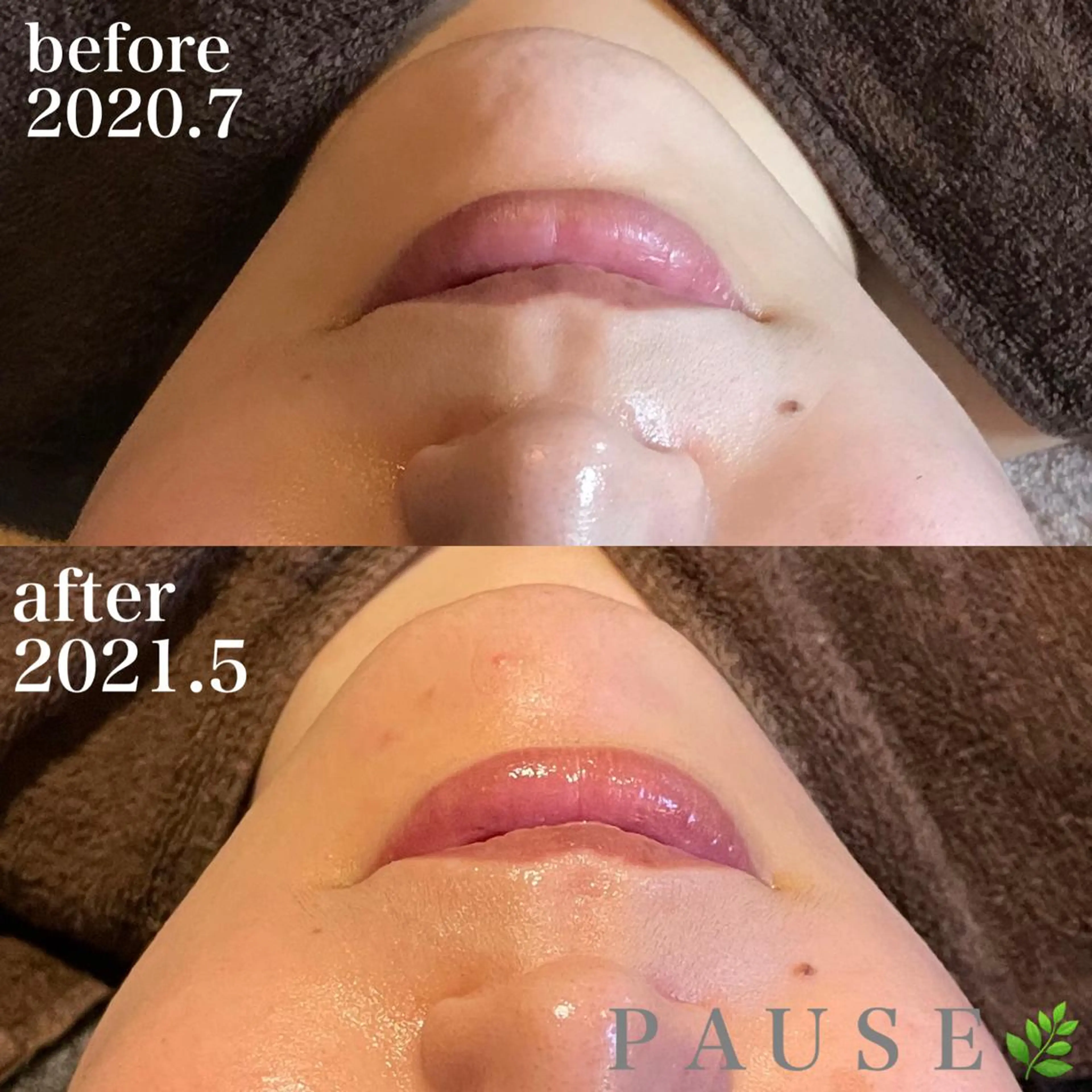 エステ 浜野 恵美のエステ・リラクイメージ