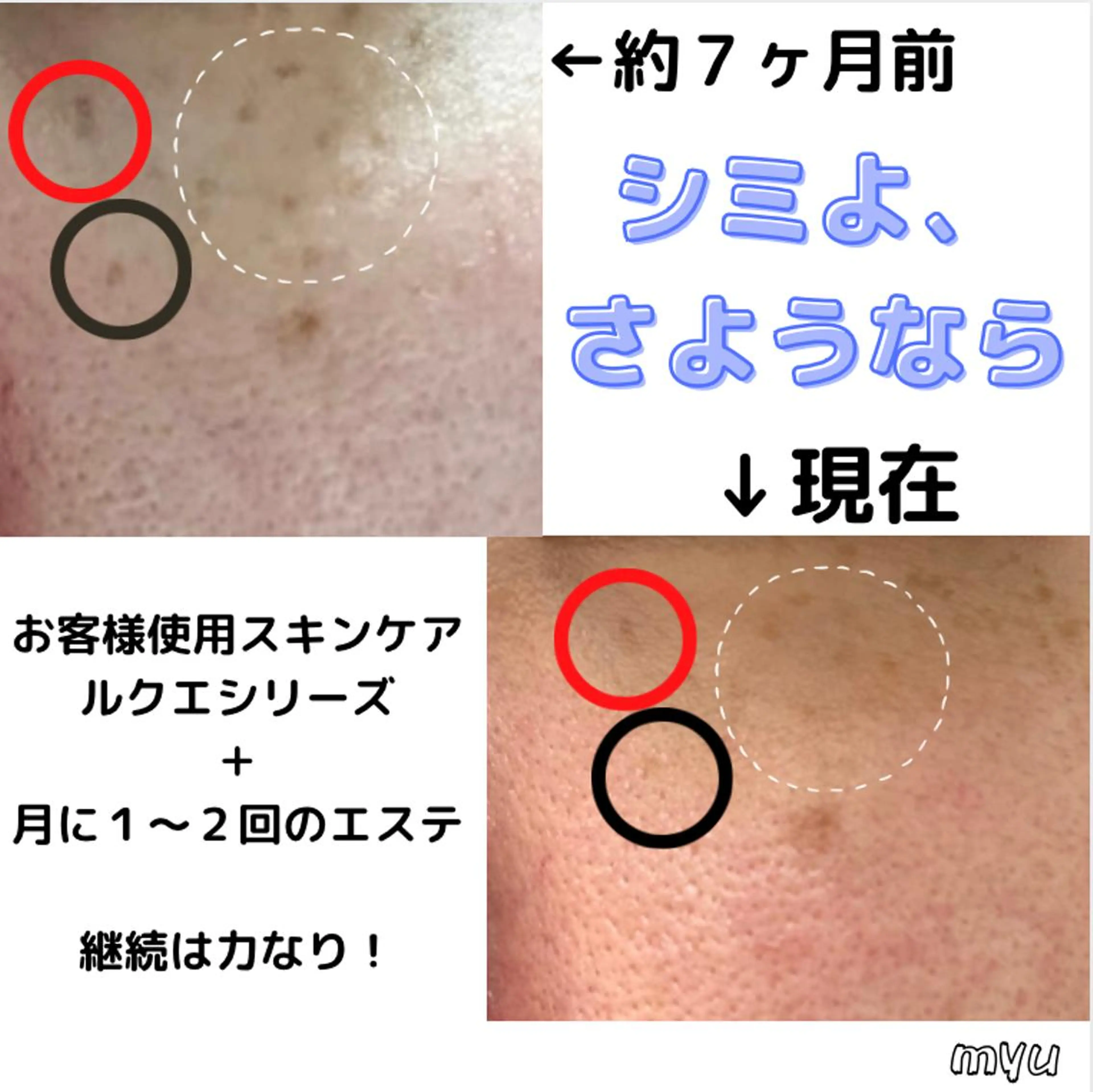 ミューズエステ 谷口美結のエステ・リラクイメージ