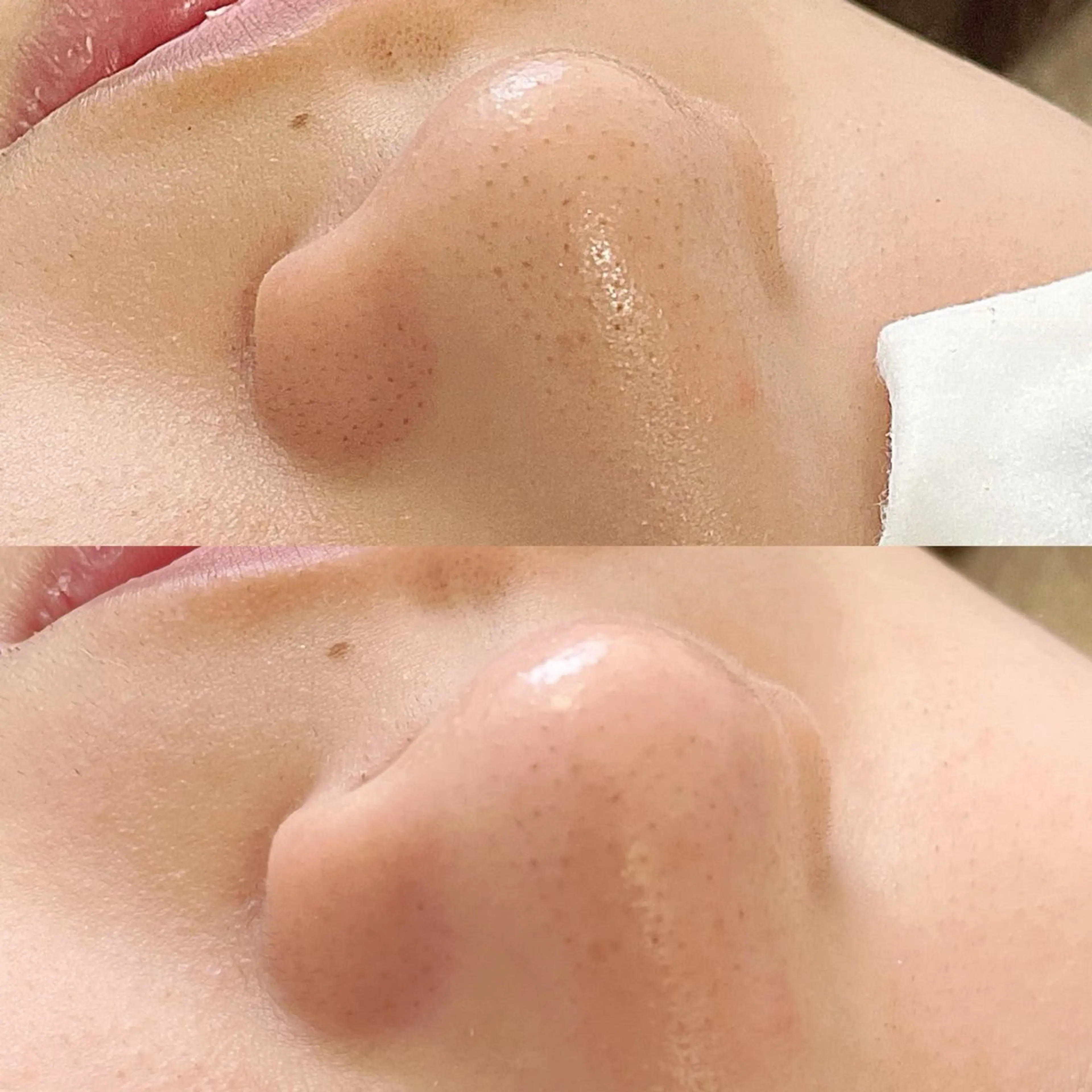 まつげ、毛穴 TREEのエステ・リラクイメージ