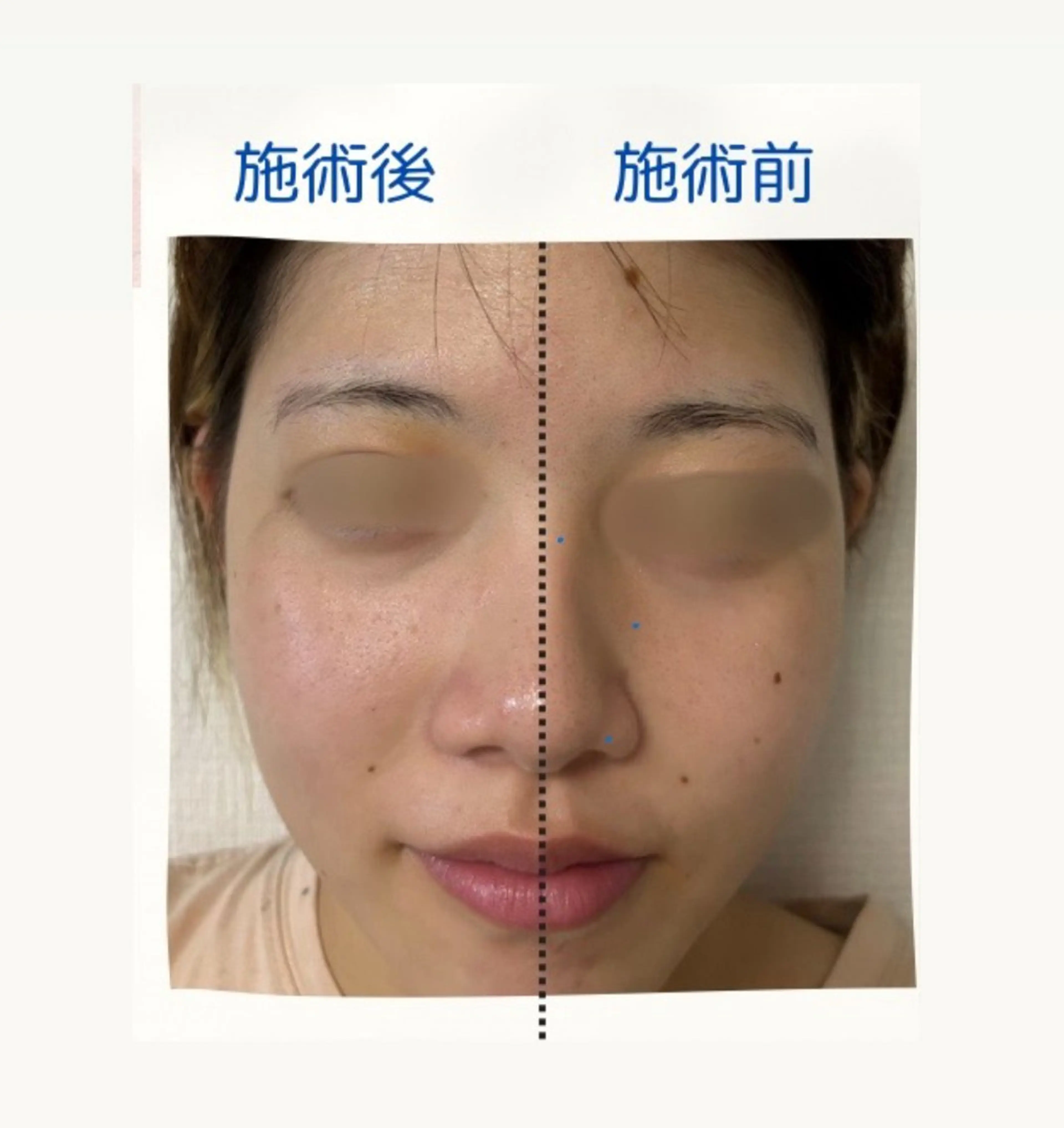 ナリスビューティサロン　デアイム津田沼所属・堀井 敏子のエステ・リラクイメージ