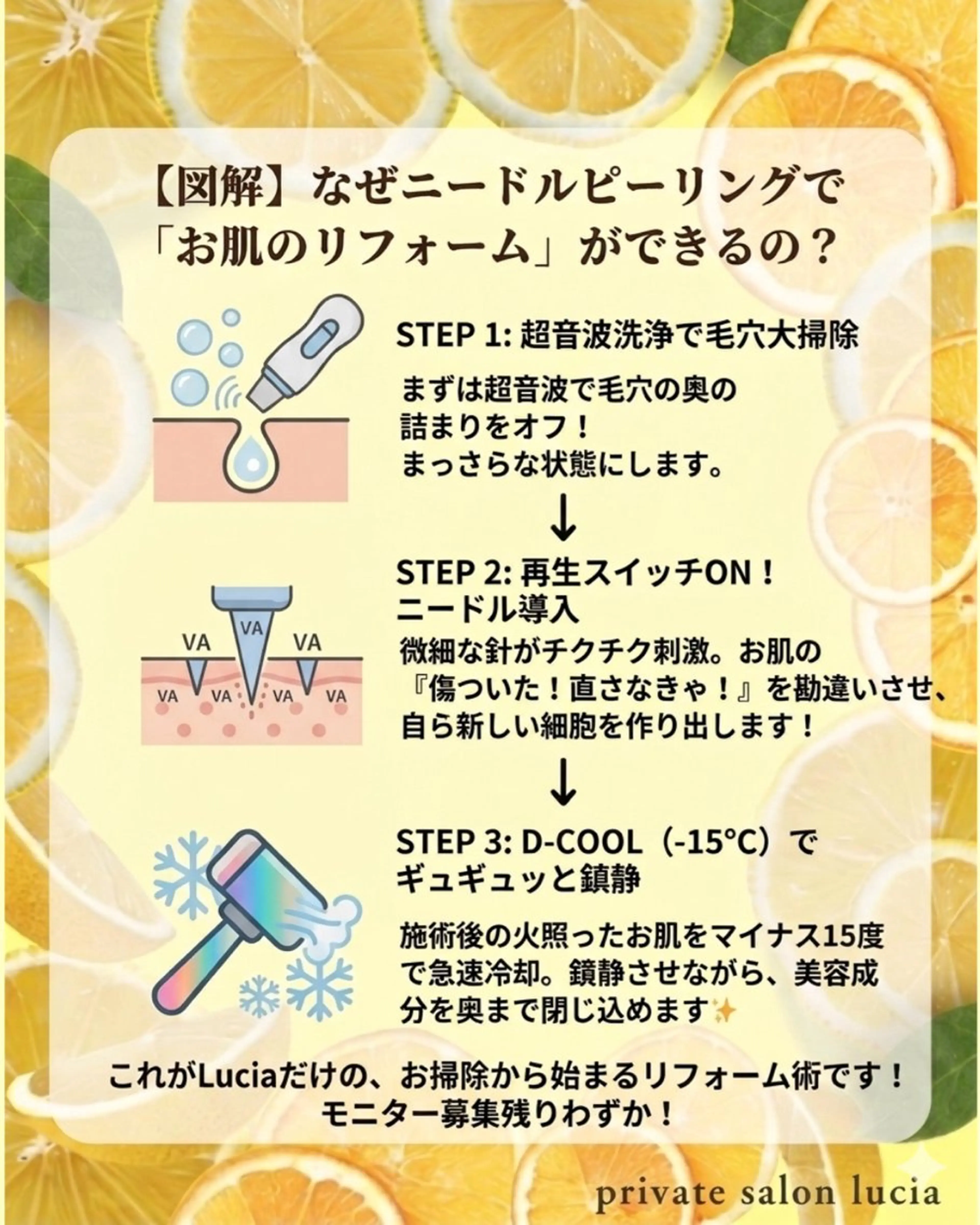 ビューティーサロンルシア所属・lucia  豊明 肌管理のエステ・リラクイメージ