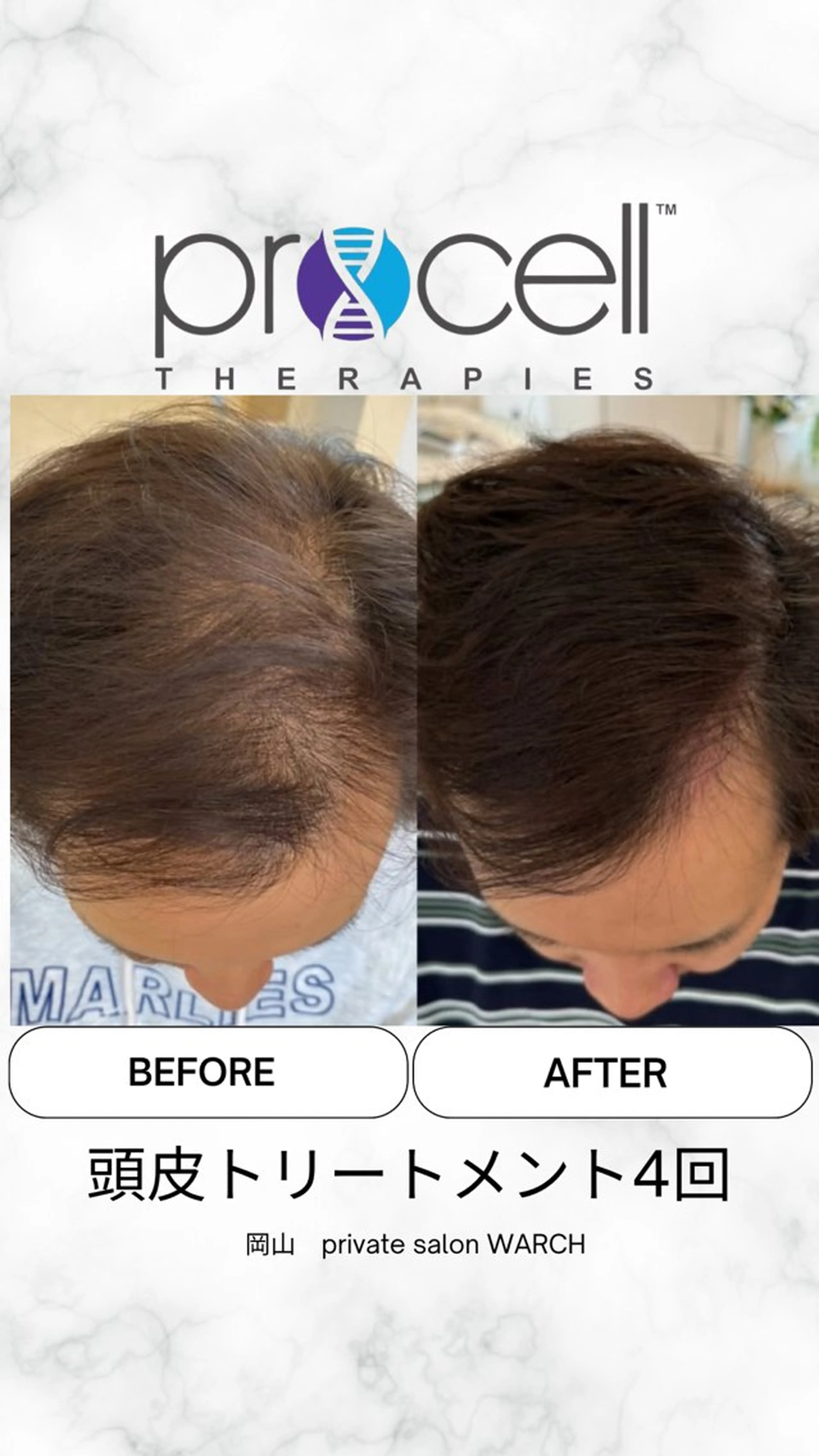 WARCH Marieのその他イメージ