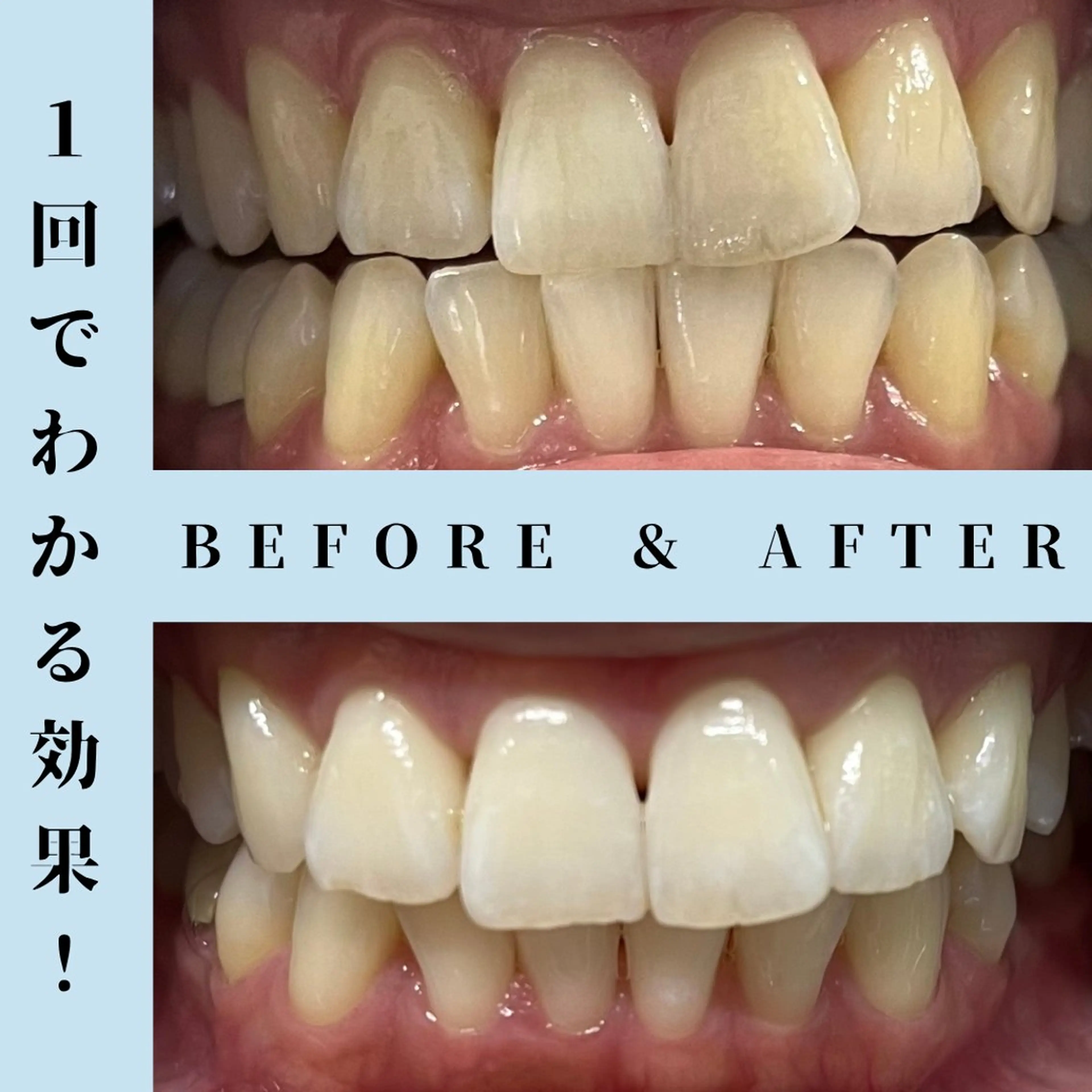 その他 セルフホワイトニング Dolce水戸店のその他イメージ