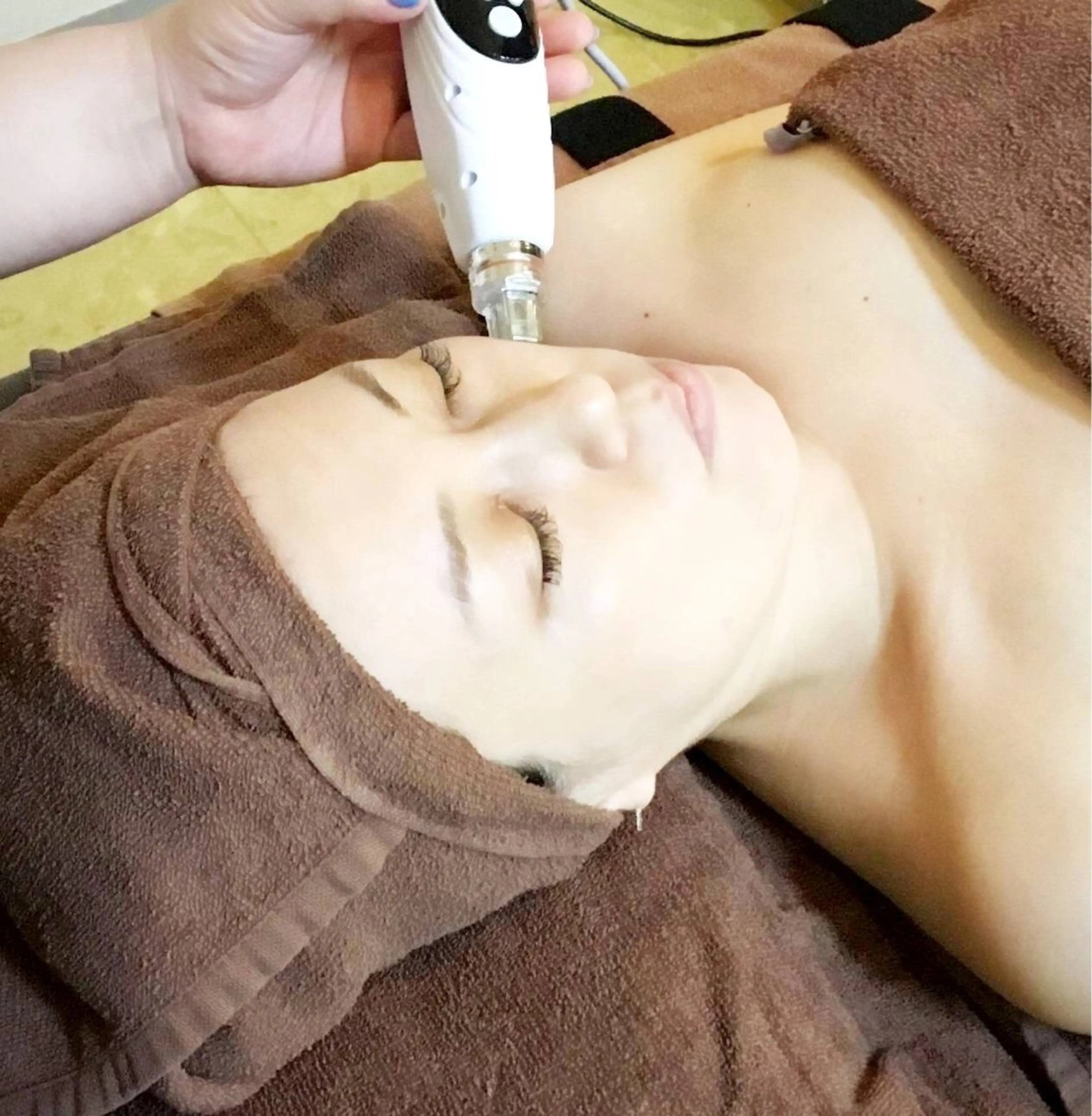 ★極☆パール肌毛穴洗浄➕水光ジェット導入60分　¥27,500→¥9,900の写真