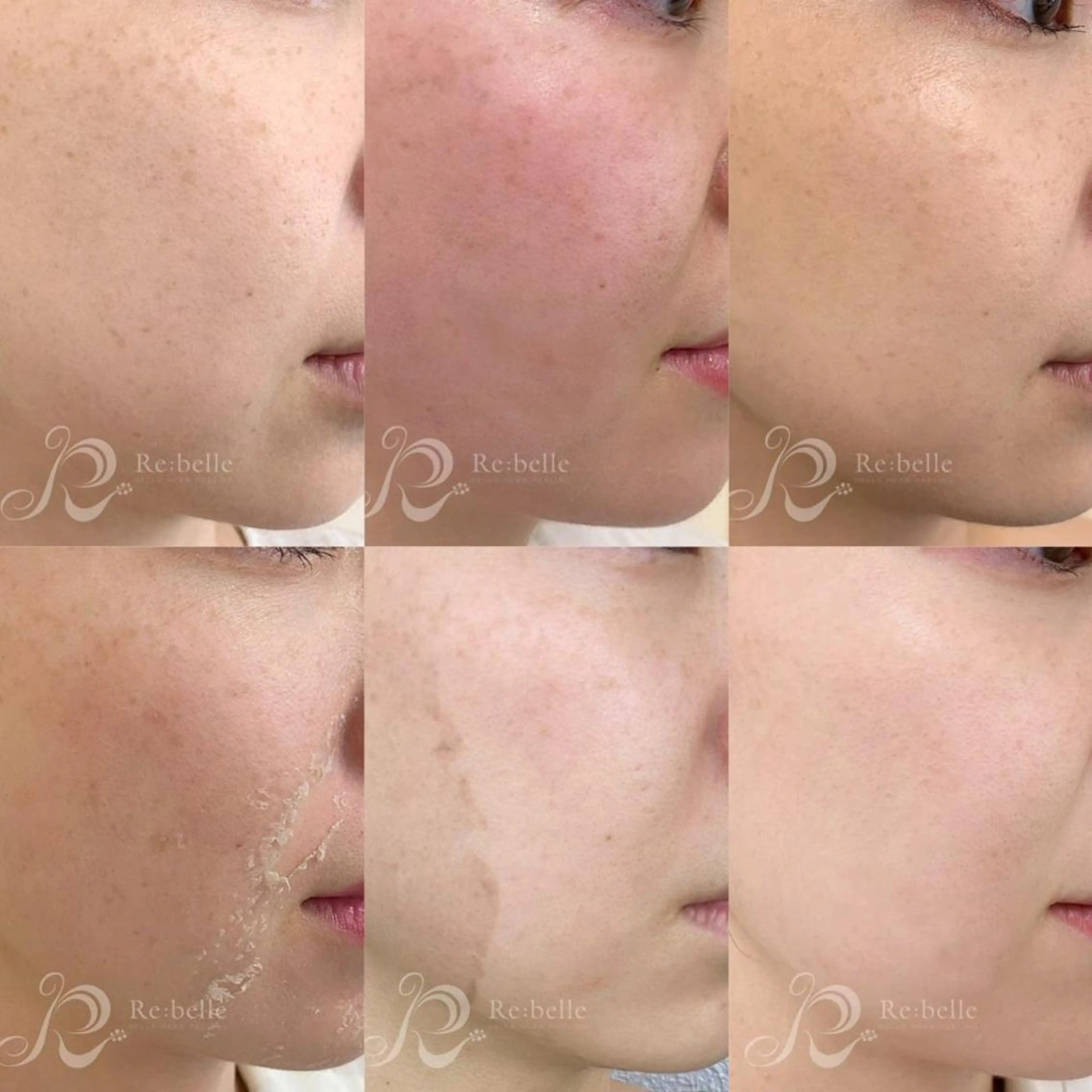 メンズ エステ The 2Swans フェイシャル サロンのエステ・リラクイメージ