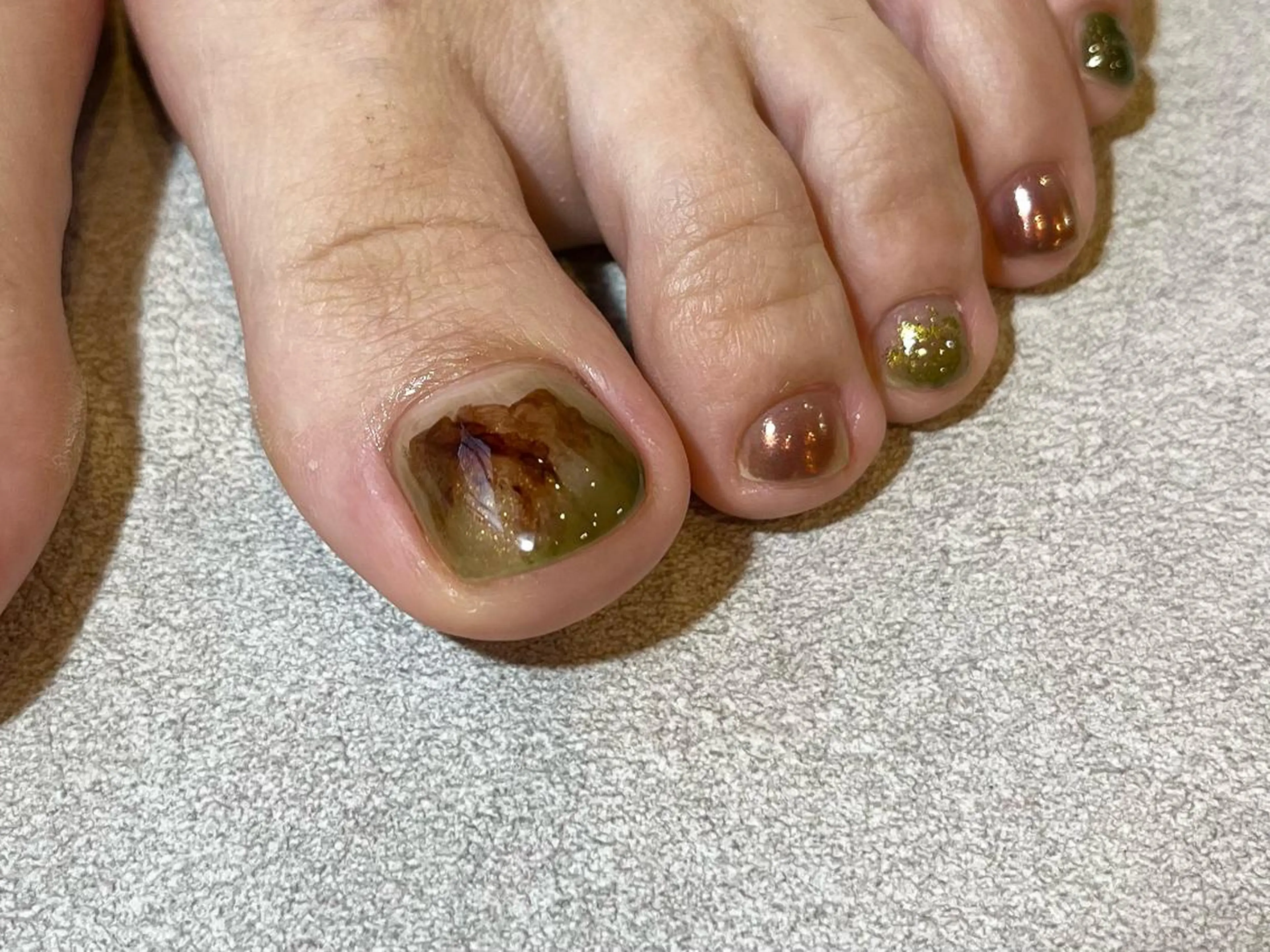 ネイル フットネイル 小河 仁美のネイルデザイン