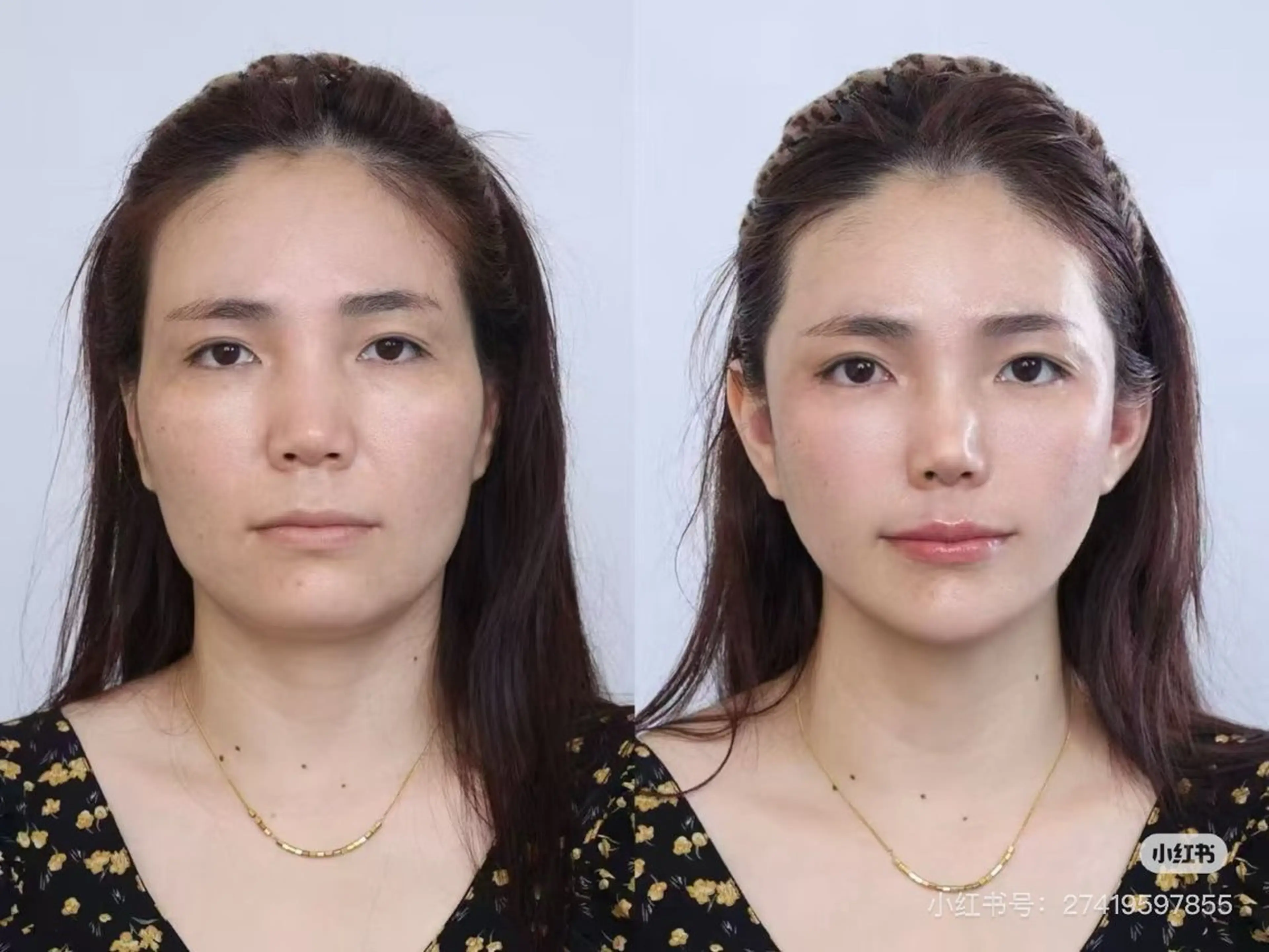 ショート その他 aliaハイフ&水光ジェットサロン所属・aliaハーブ水光店 エステティシャン募集のエステ・リラクイメージ