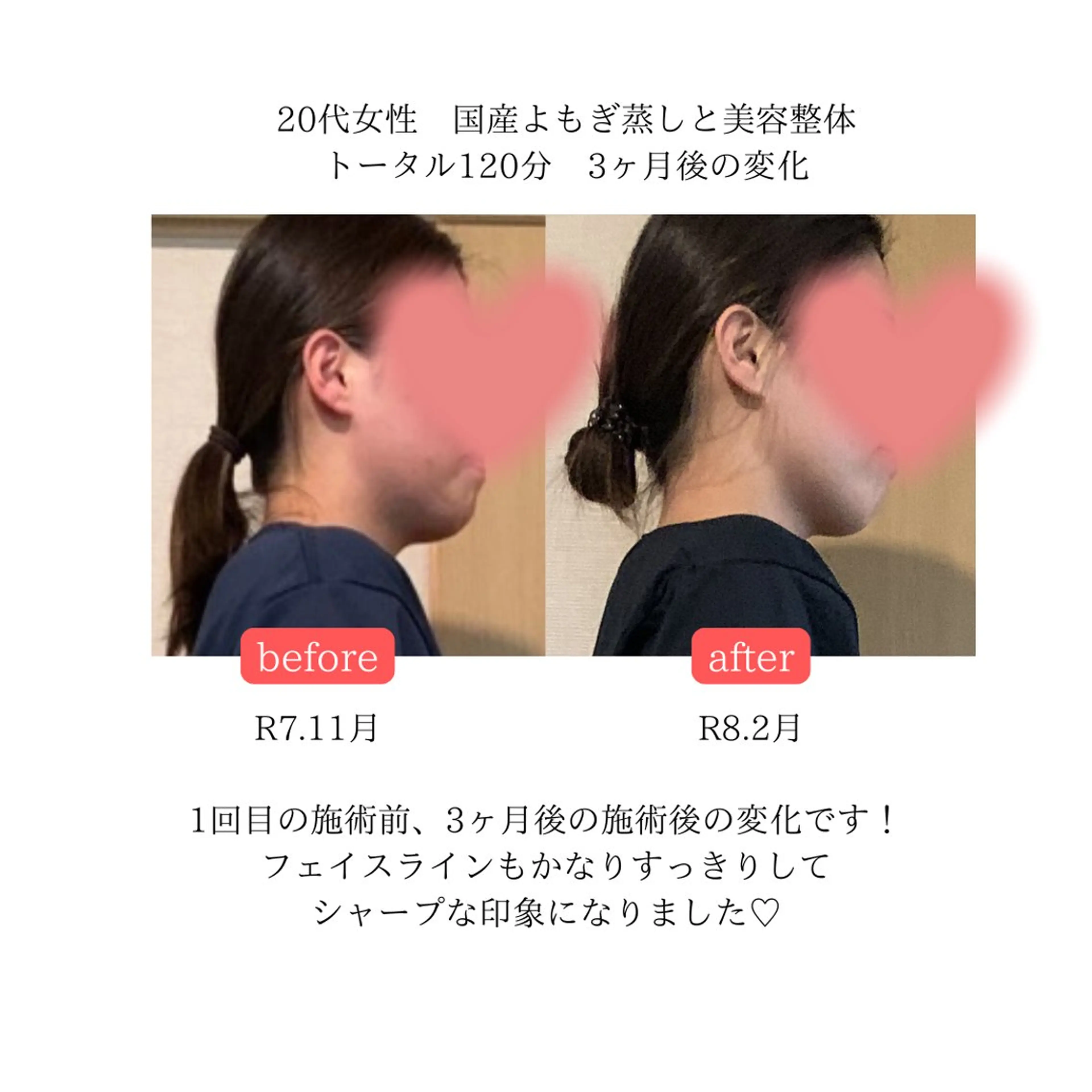 一坪(ひとツボ)サロンあぷり所属・よもぎ蒸し・腸もみ 石川理沙のエステ・リラクイメージ