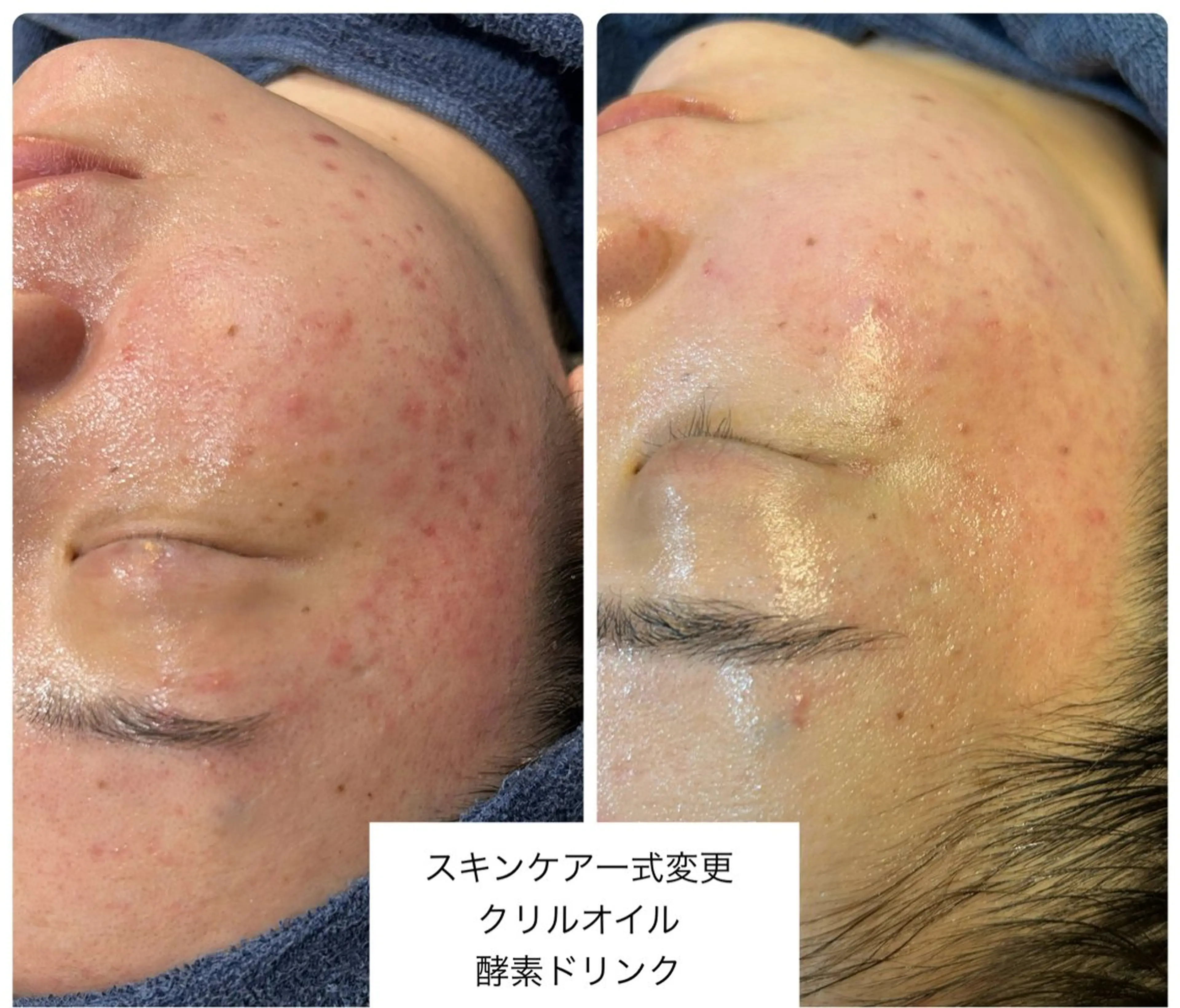 leolo武蔵浦和 肌質改善＆脱毛のエステ・リラクイメージ