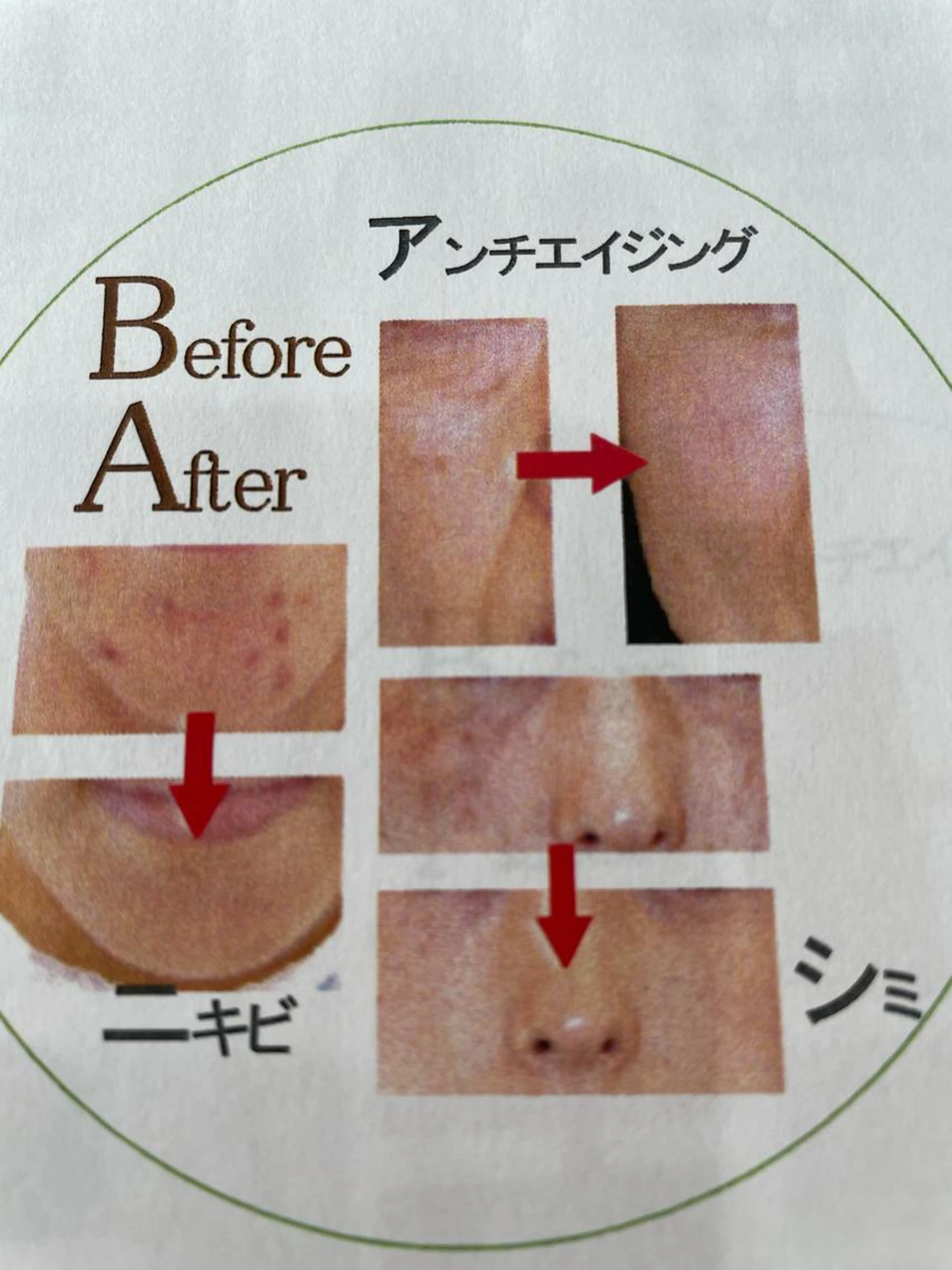 リセルシュールクリニカルトリートメントの写真