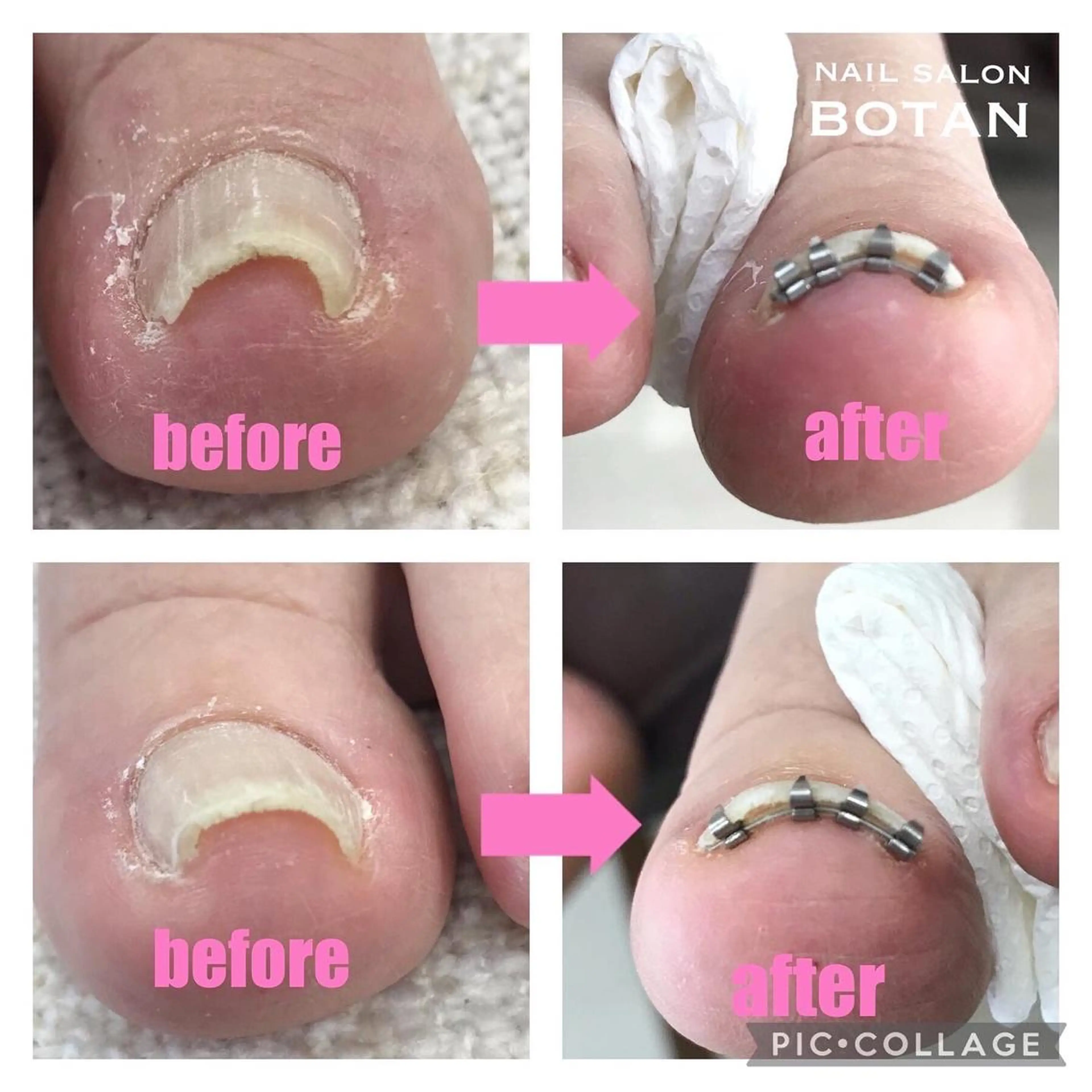 ネイル NAIL SALON BOTANのネイルデザイン