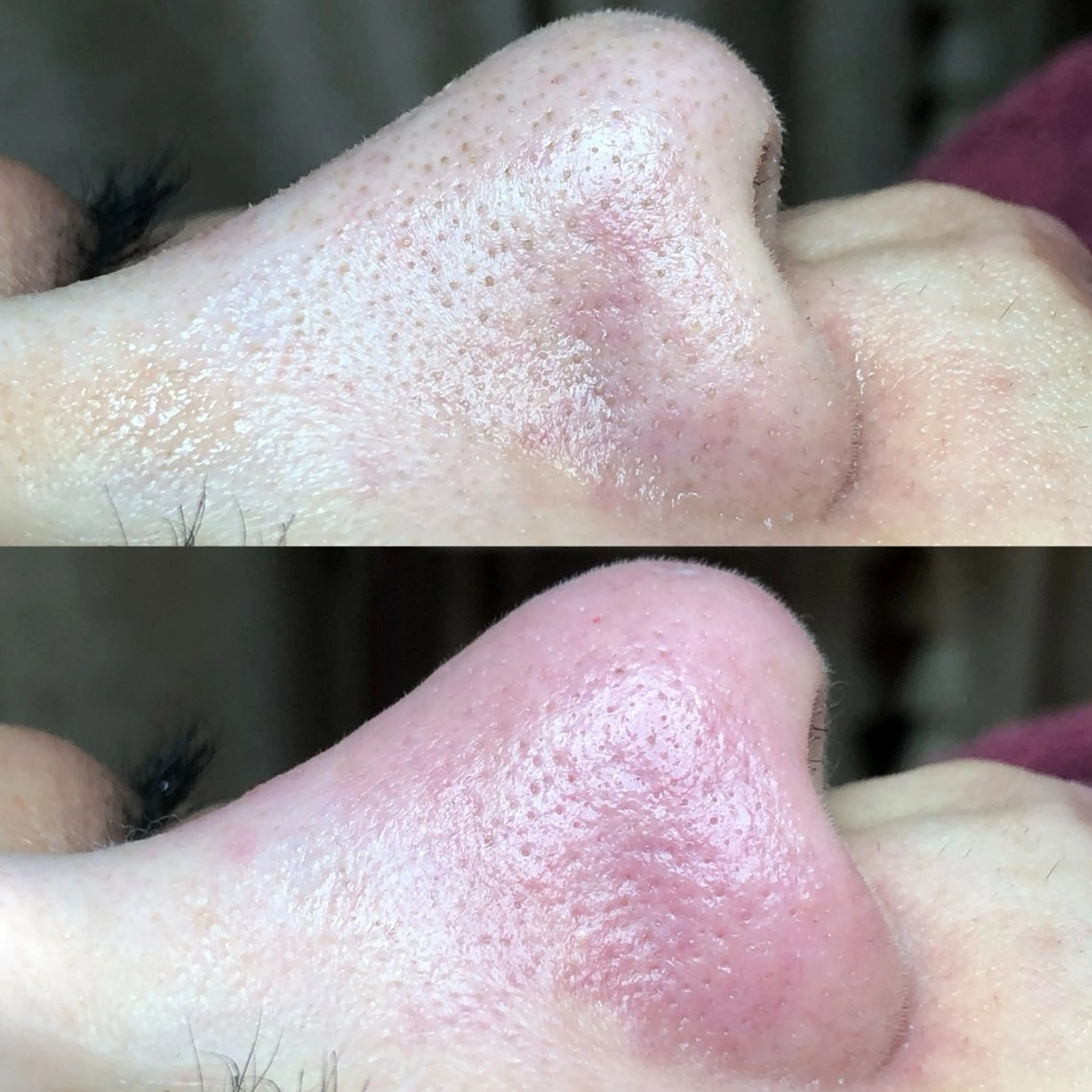 毛穴シミケア専門店aloha malie所属・水野 彩のエステ・リラクイメージ