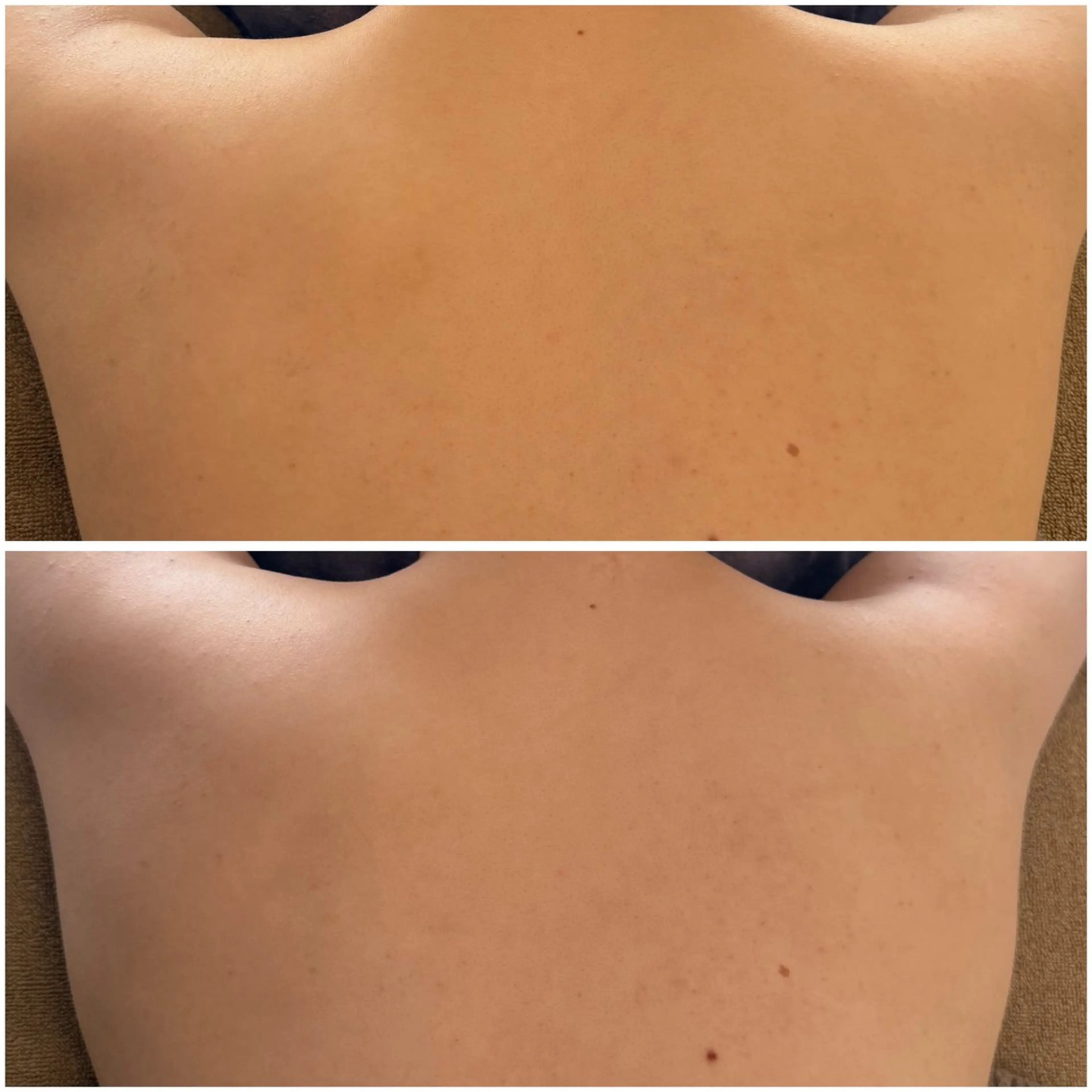 エステ snow flakeのエステ・リラクイメージ