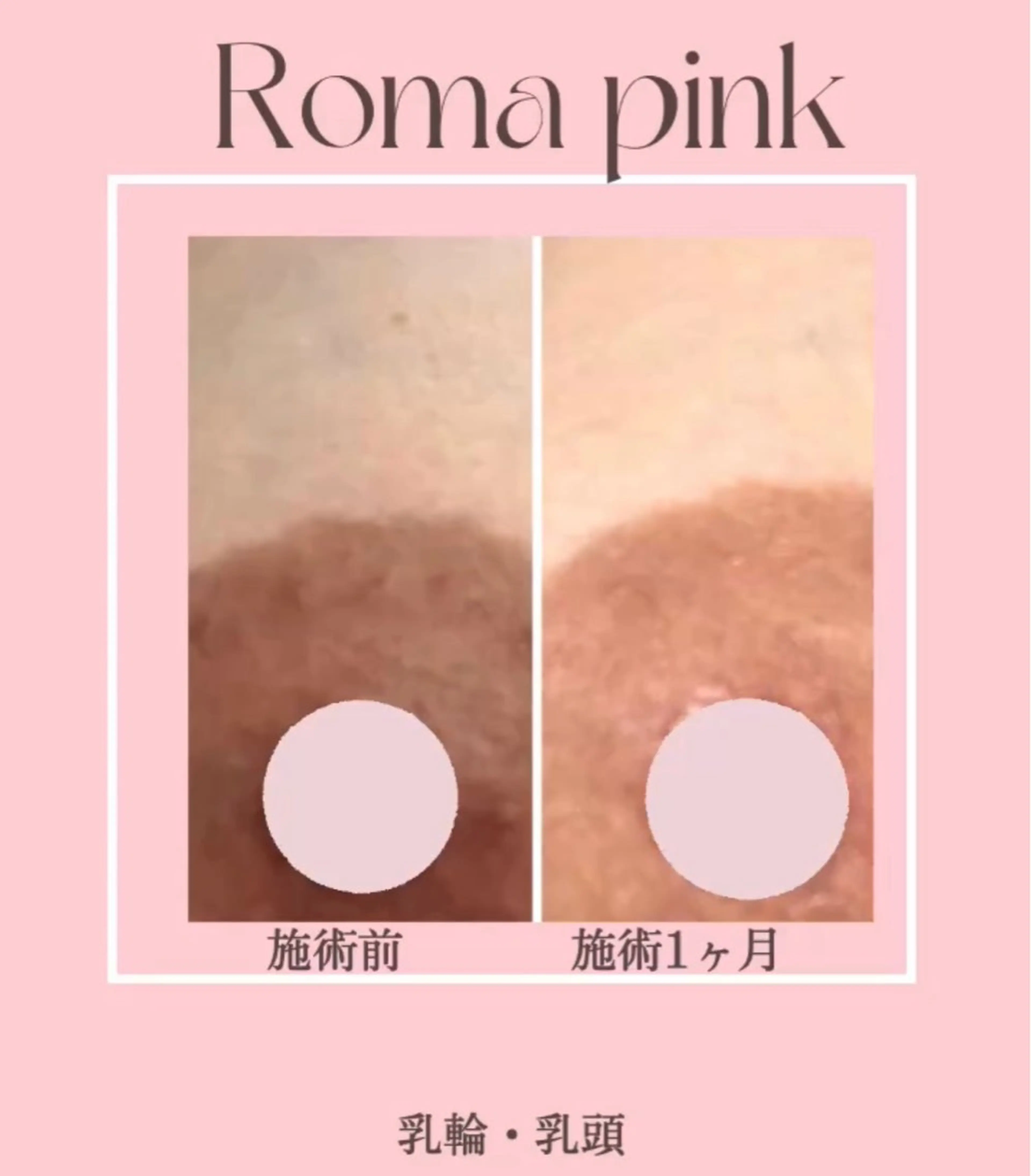 LiLL by Andre beauty所属・LiLL 熊本のその他イメージ