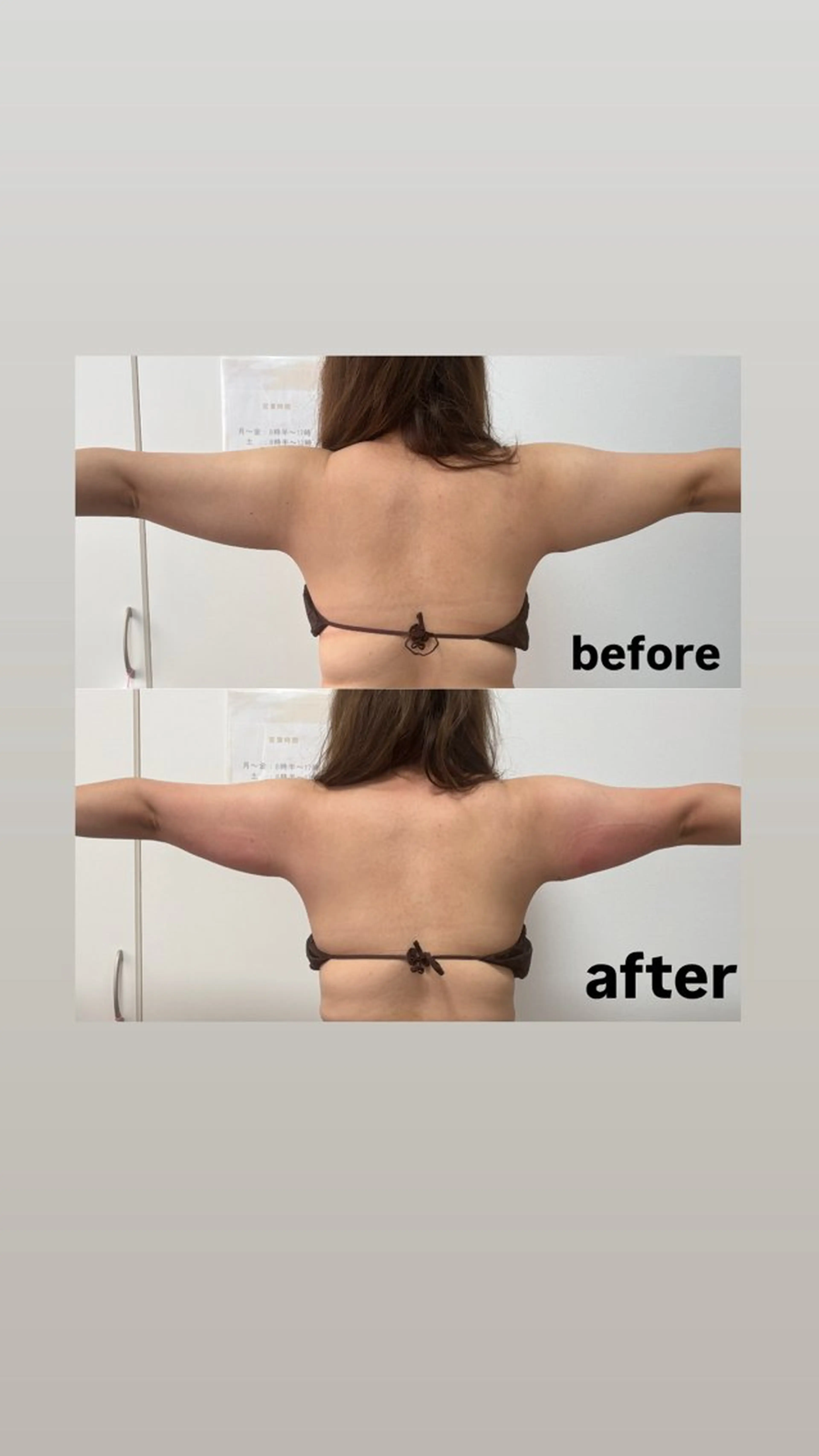 エステ Miiju.所属・石巻 冷却痩身 Miiju. 鈴木のエステ・リラクイメージ