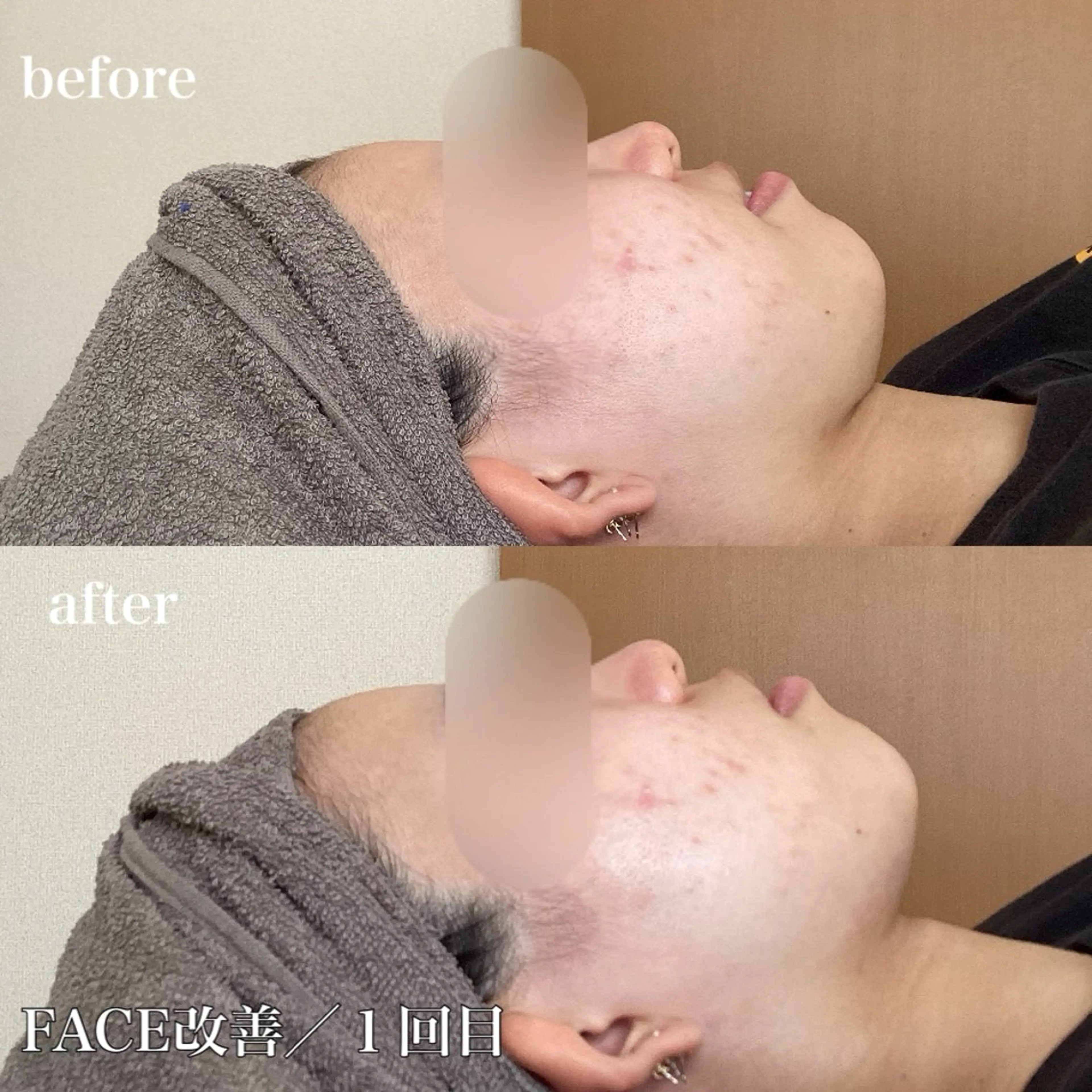 磐田｜LAYLA 一番丁寧な脱毛店のエステ・リラクイメージ