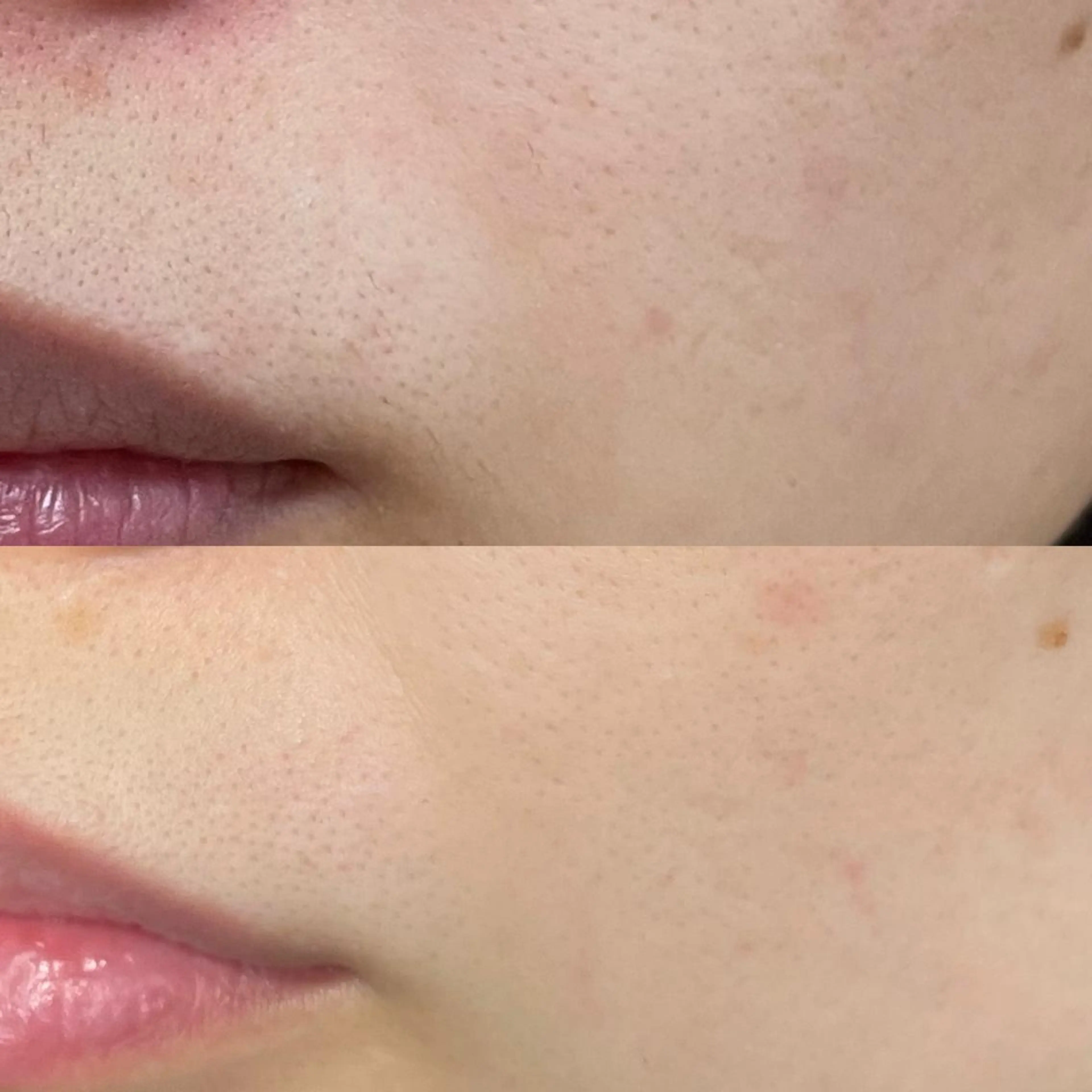 メンズ キッズ 脱毛SALON RaYNiCKのエステ・リラクイメージ