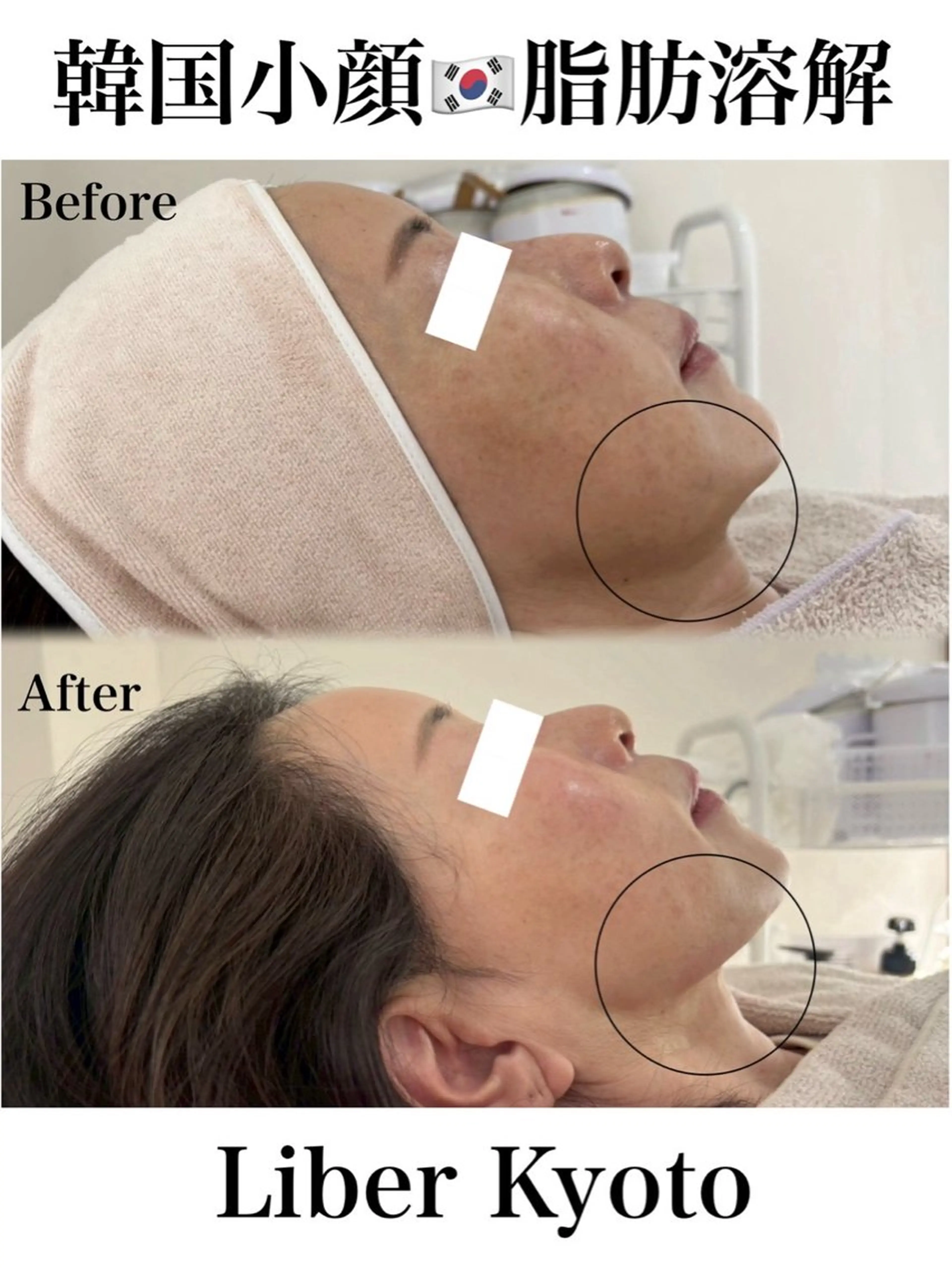 エステ Liber【リベル】 AYAKAのエステ・リラクイメージ