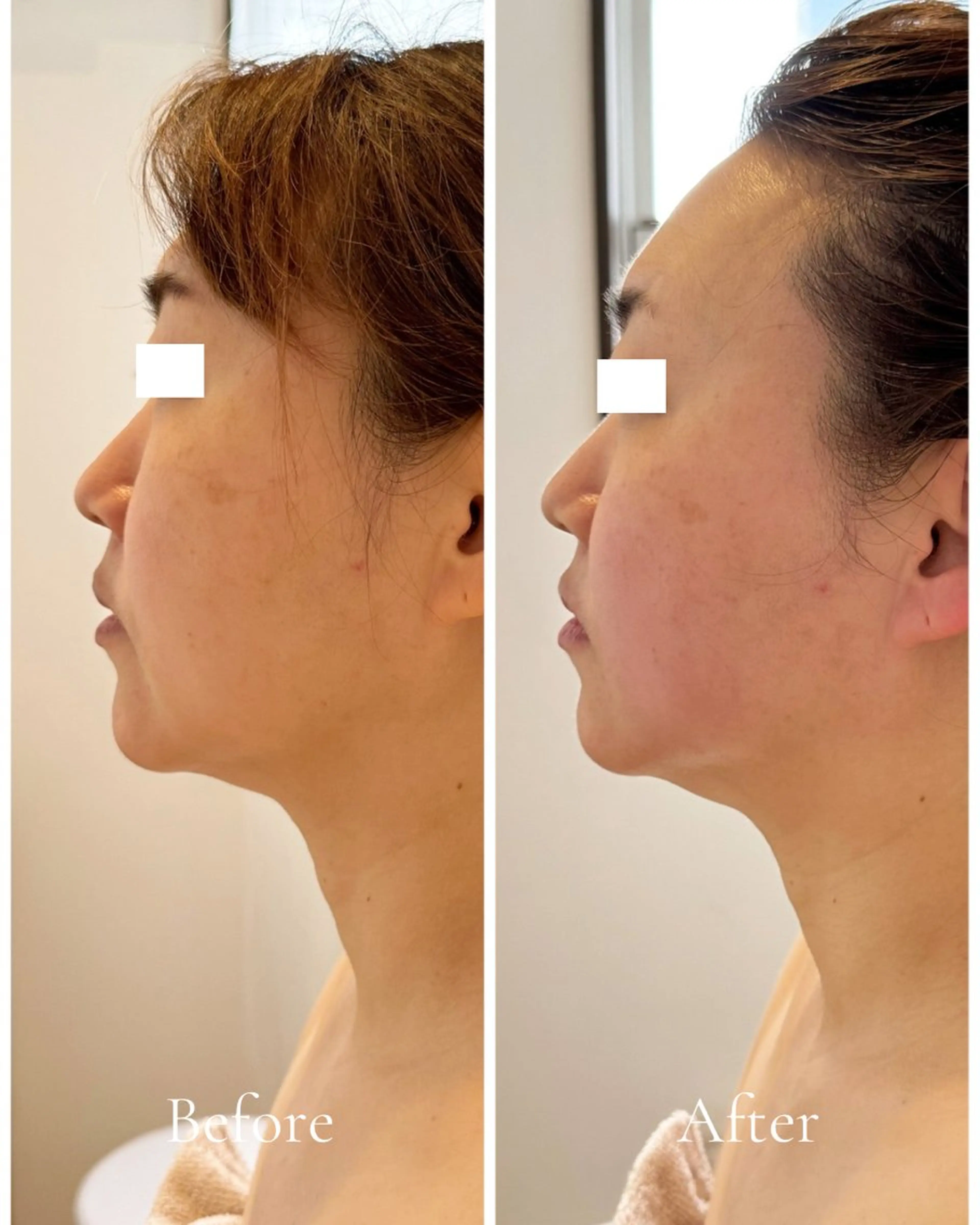 Lani Moon所属・⟡ 京都 小顔  ⊹ Lani Moonのエステ・リラクイメージ