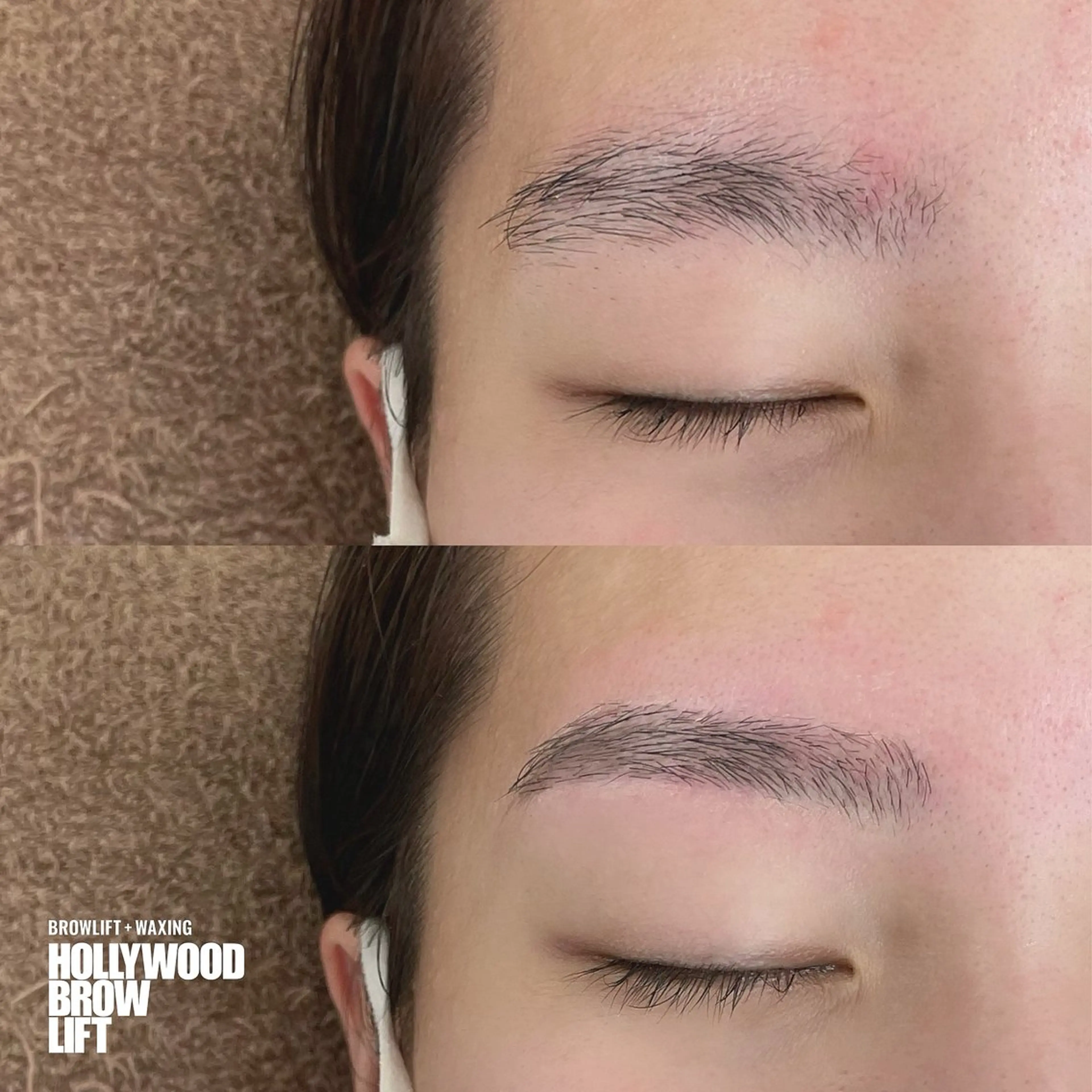 ハリウッドブロウリフト（HBL）の写真