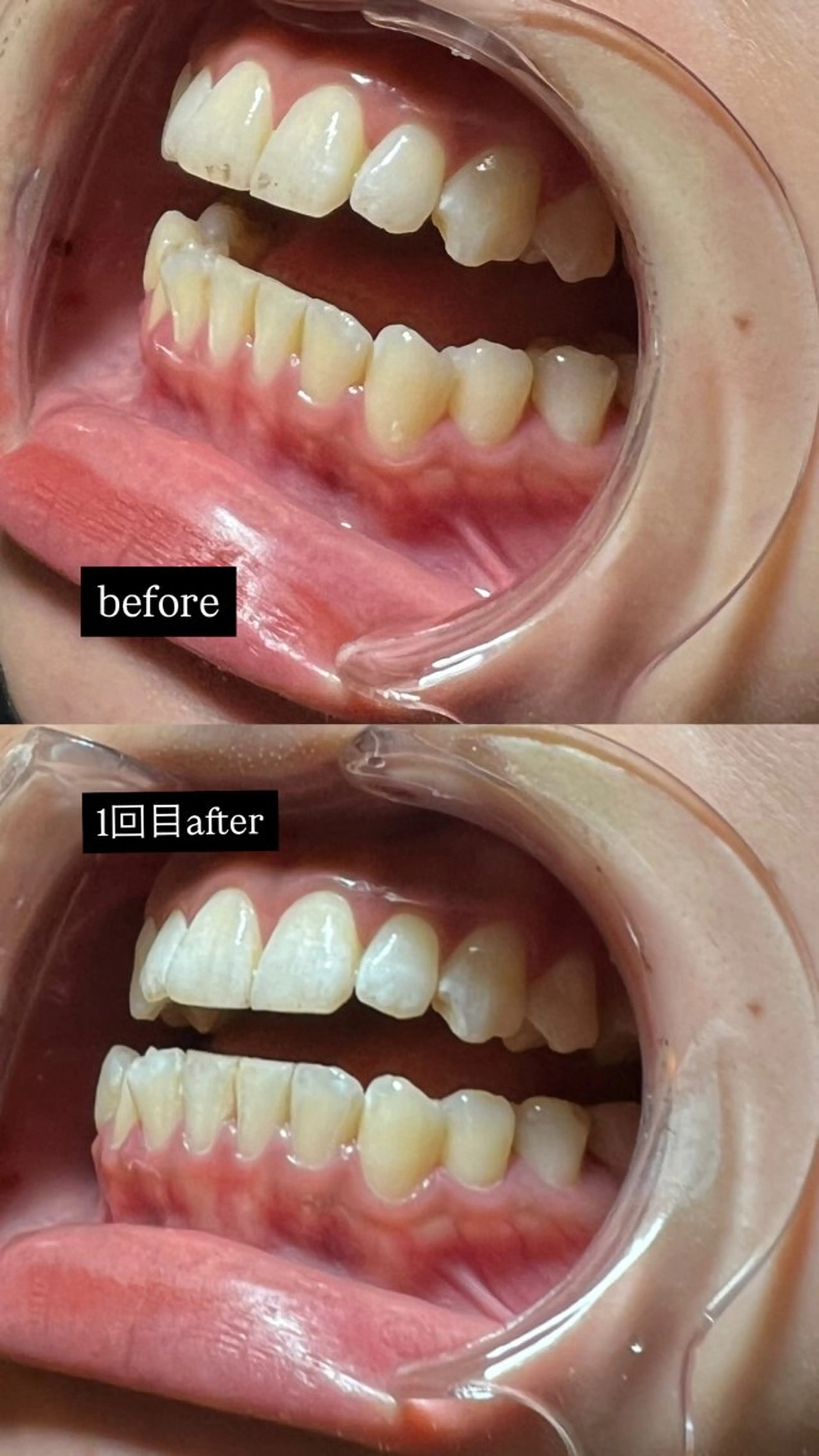 be.me yuunaのネイルデザイン