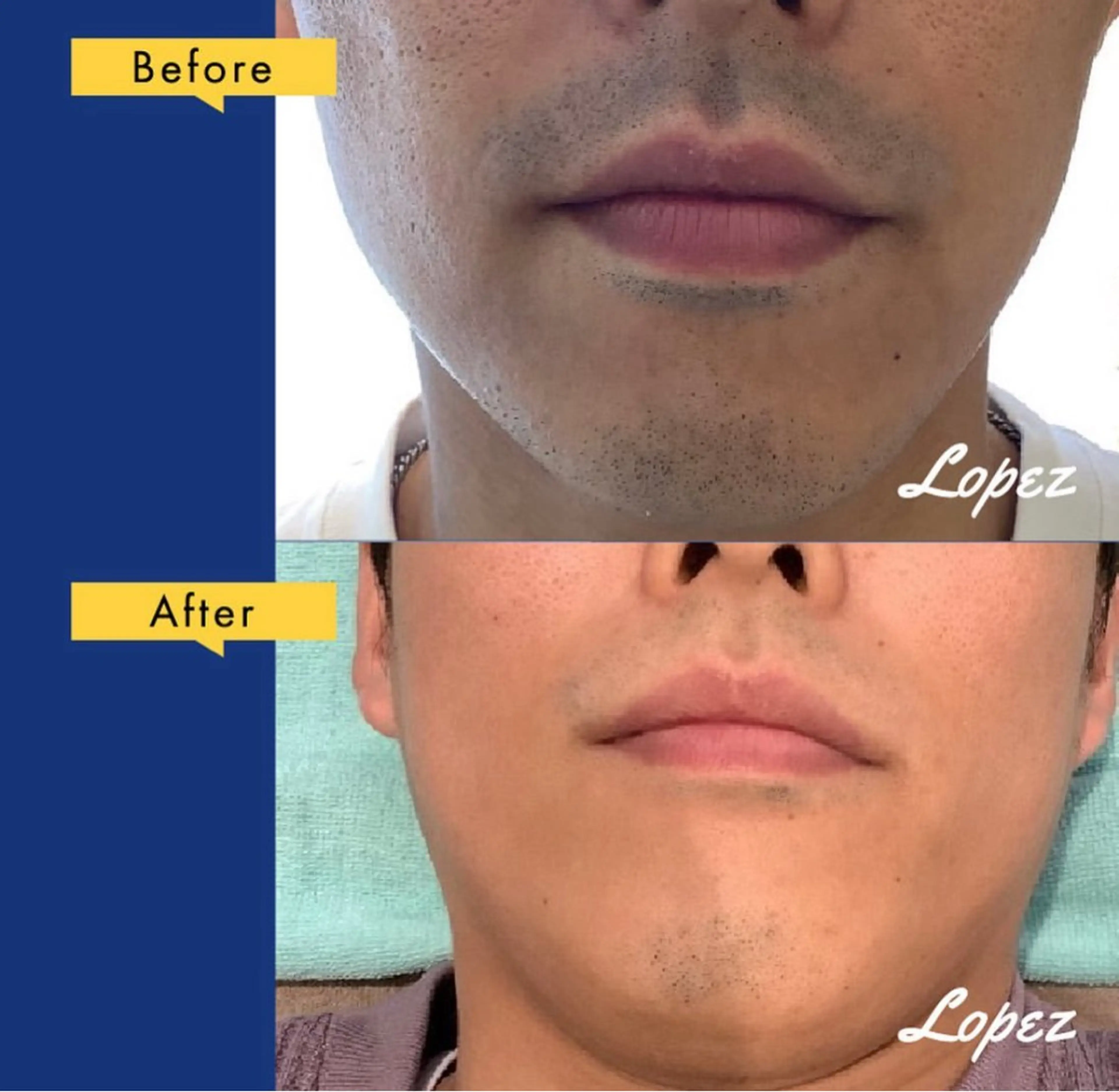 メンズ メンズ脱毛エステサロンロペス所属・小池 里穂のエステ・リラクイメージ