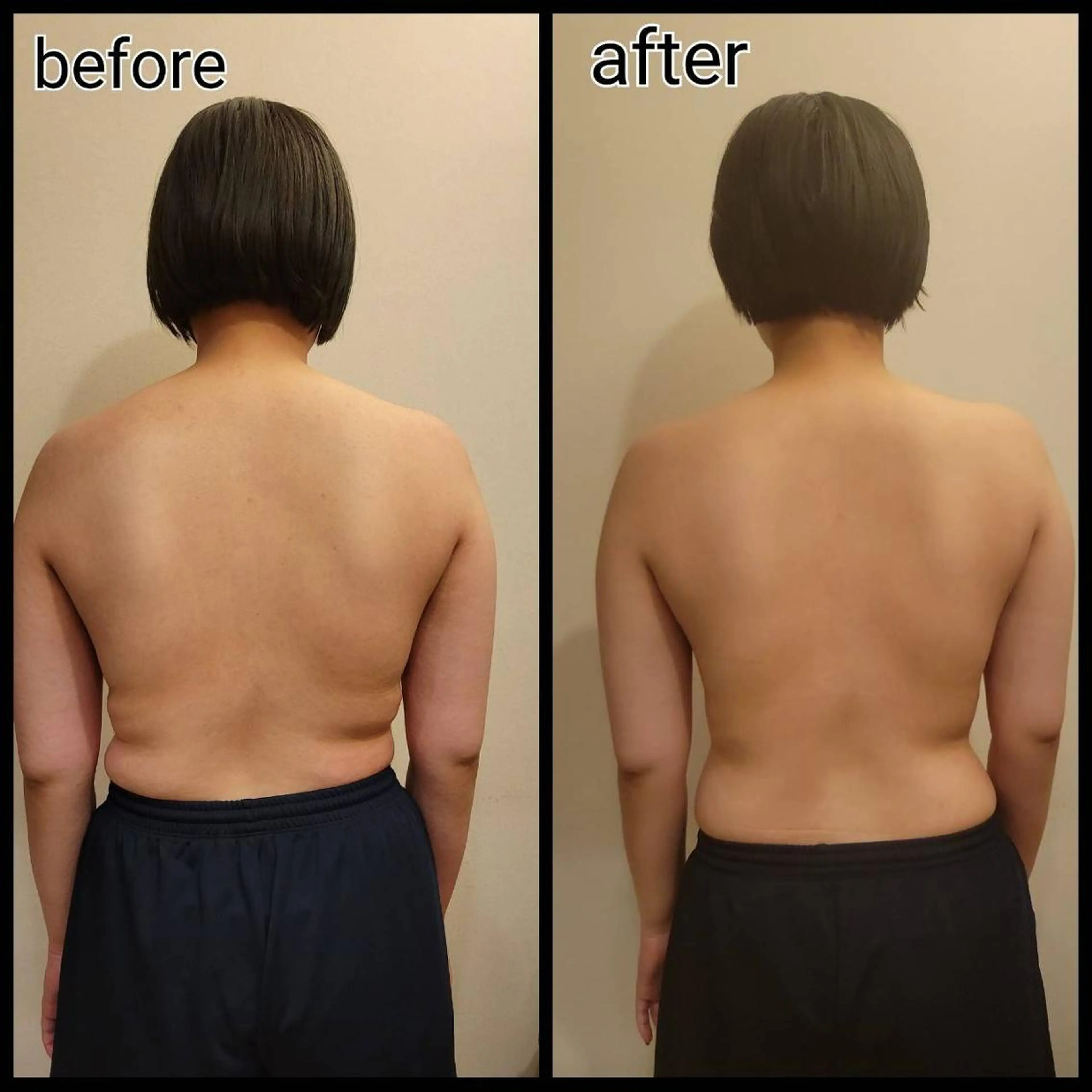 疲労回復☆ラジオ波温活エステ　90分/5,300円の写真