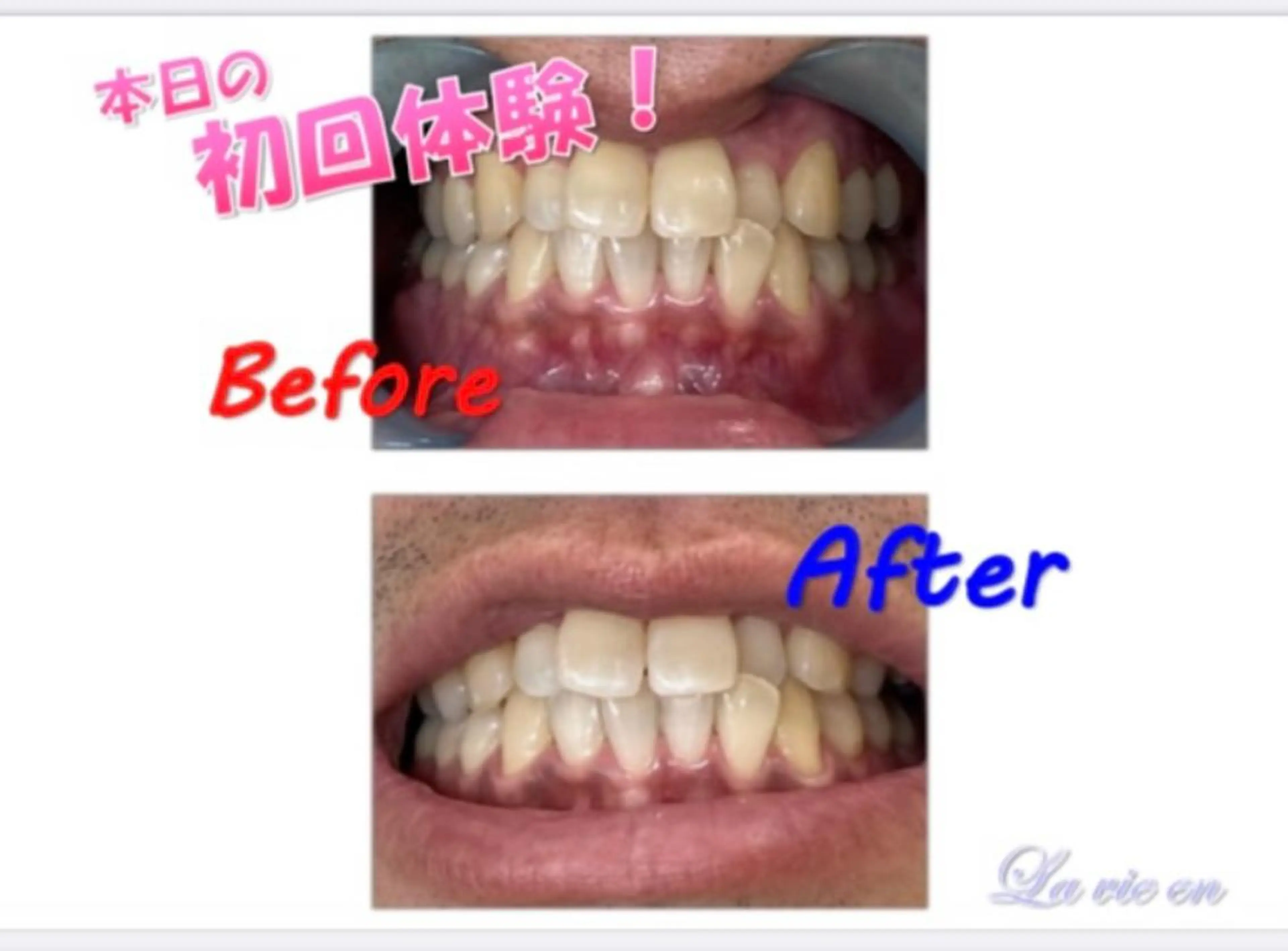 その他 セルフホワイトニングサロン　ラヴィアン所属・ホワイトニングサロン La vie enのその他イメージ