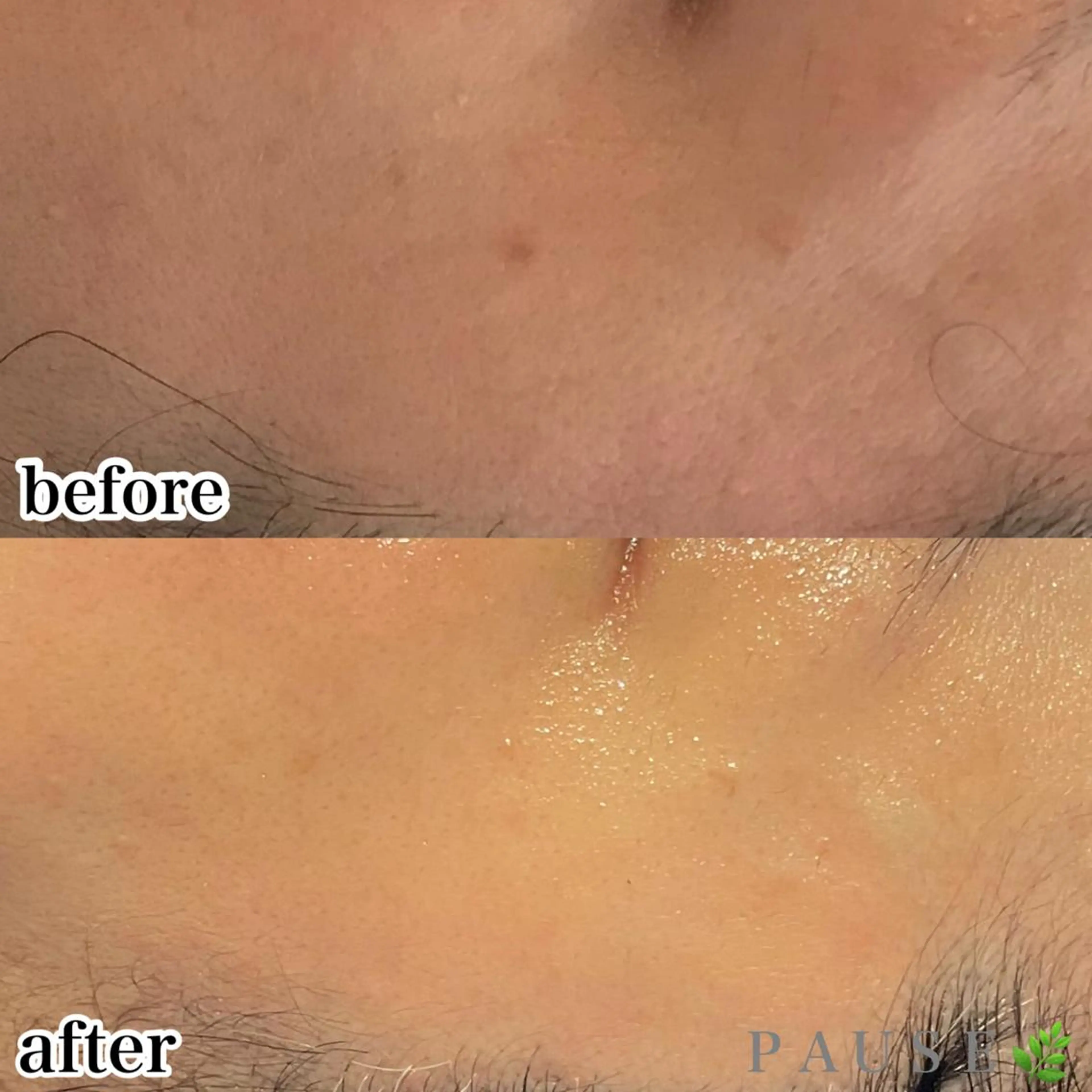 エステ 浜野 恵美のエステ・リラクイメージ