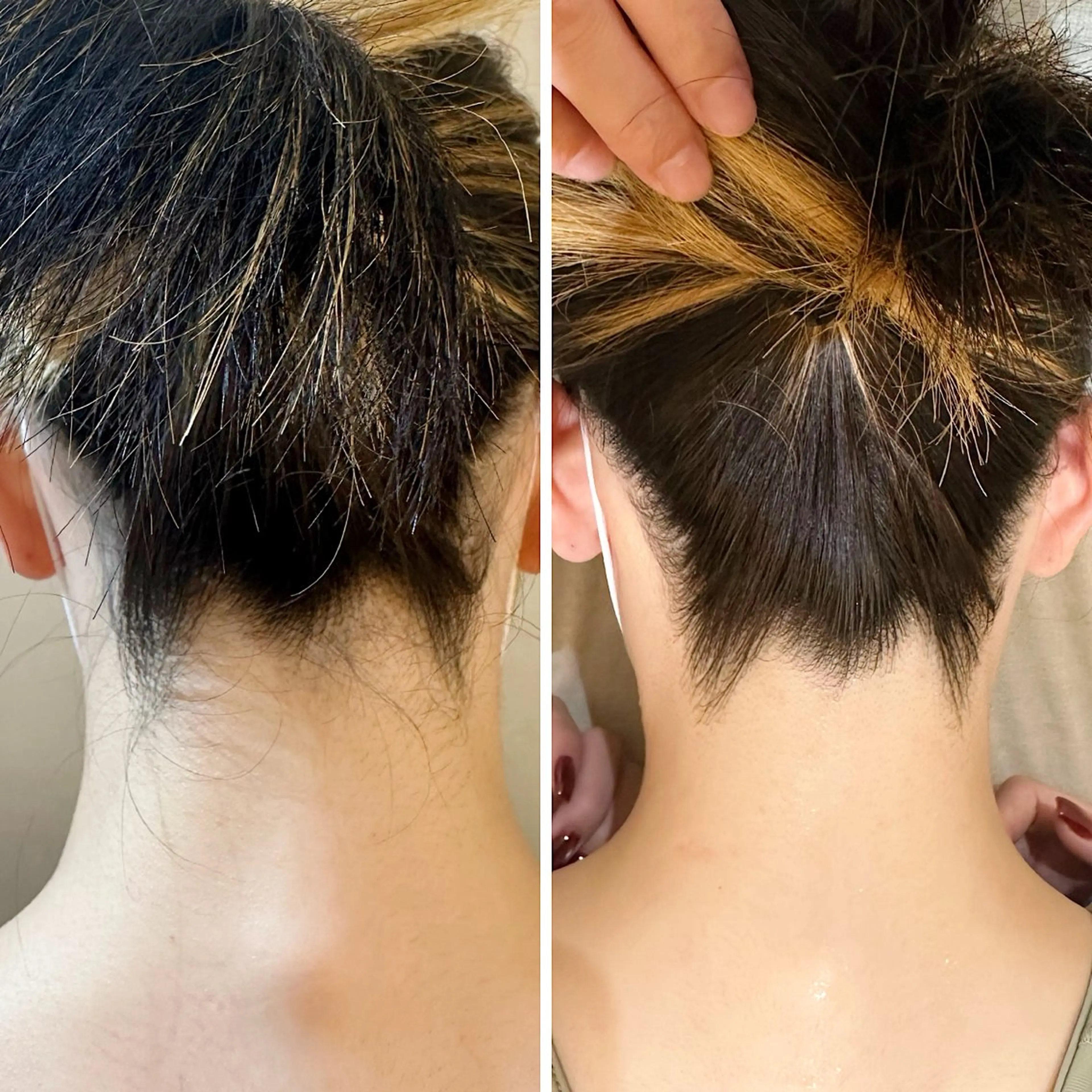 脱毛 うなじ脱毛/美肌脱毛 LABELのエステ・リラクイメージ