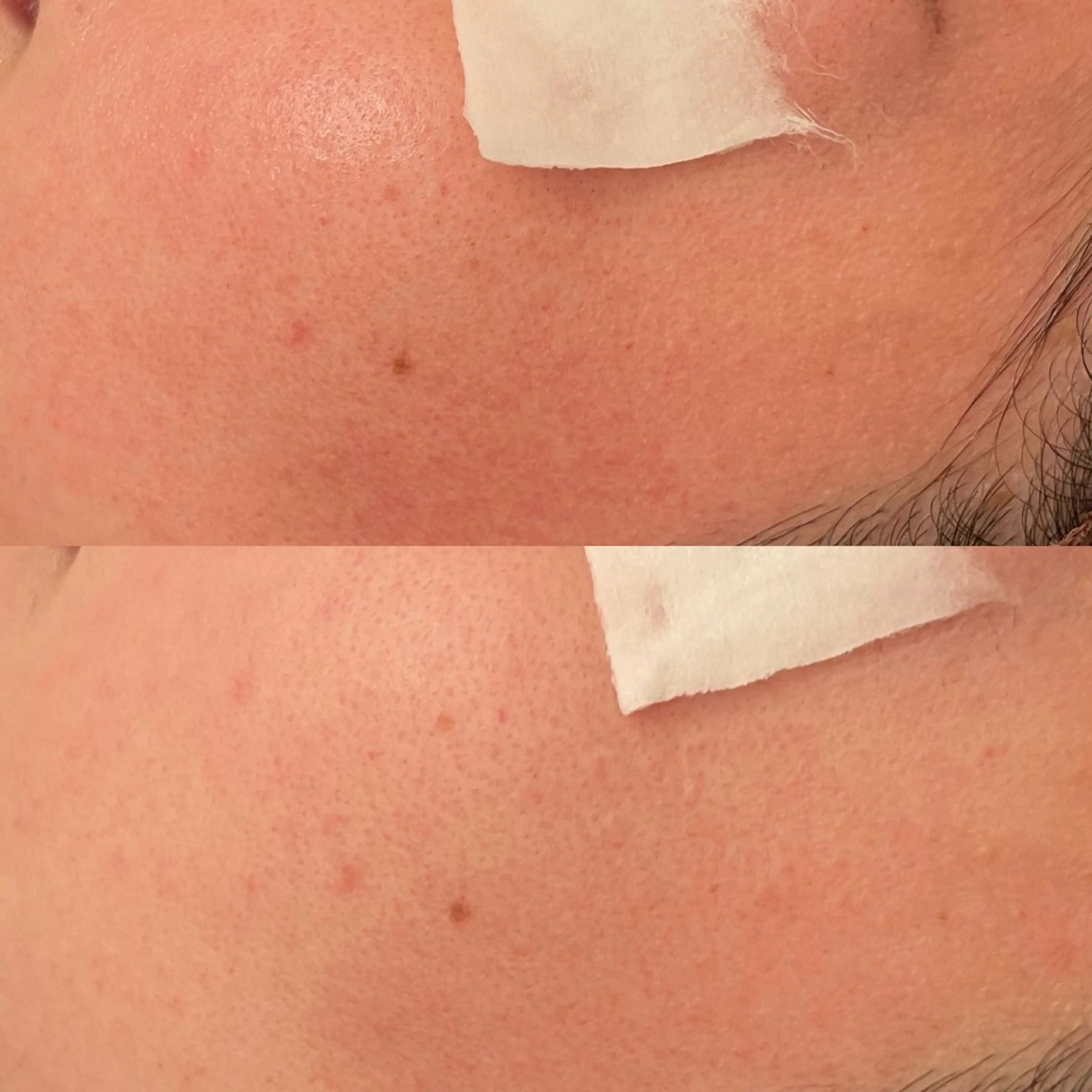 エステ 毛穴ケア/毛穴診断/ 毛穴洗浄〔心斎橋〕のエステ・リラクイメージ