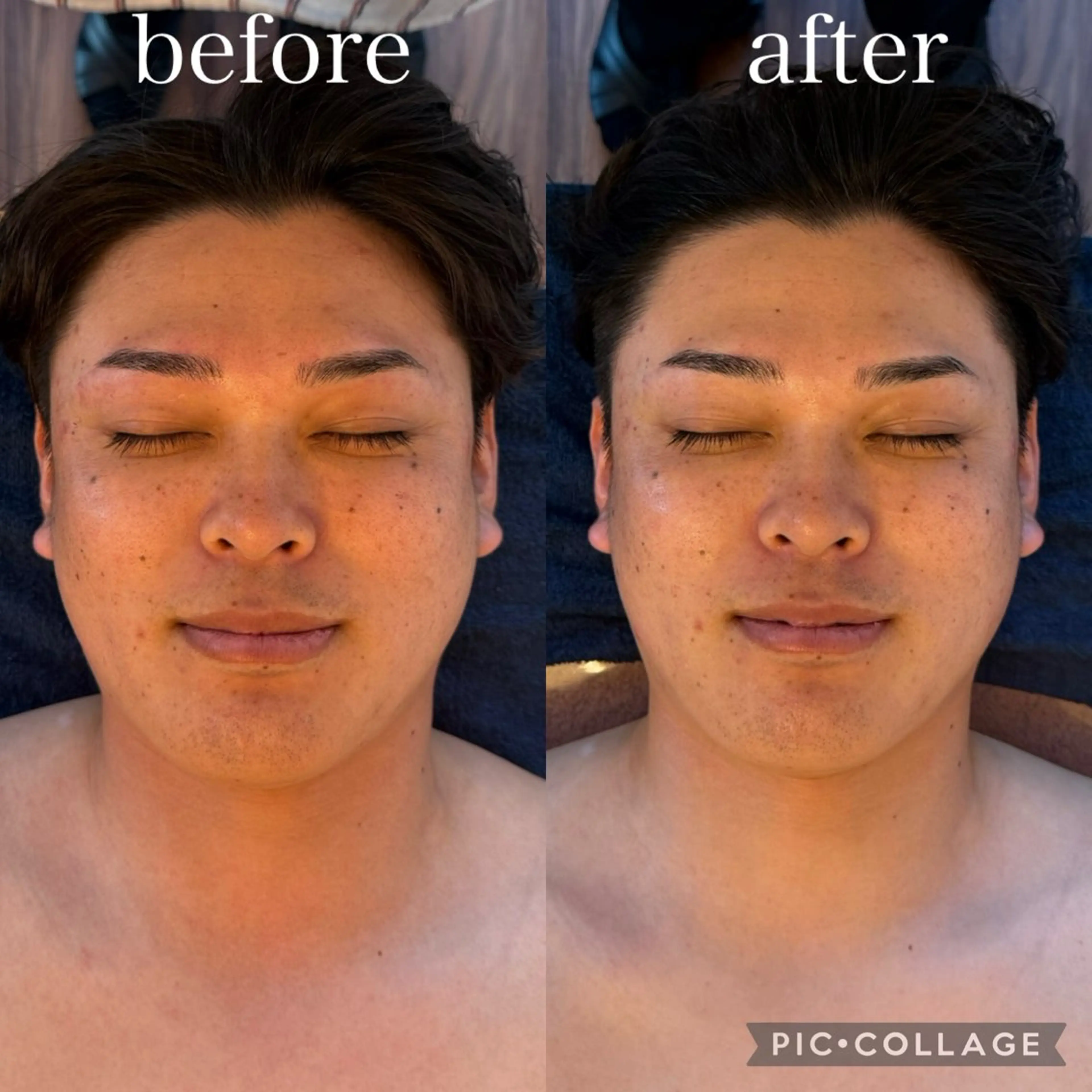 【リピーター様✨】本格的！本場韓国式🇰🇷韓国アイドル必須項目✅小顔筋膜リリースコルギコース💆🏻‍♀️💕の写真