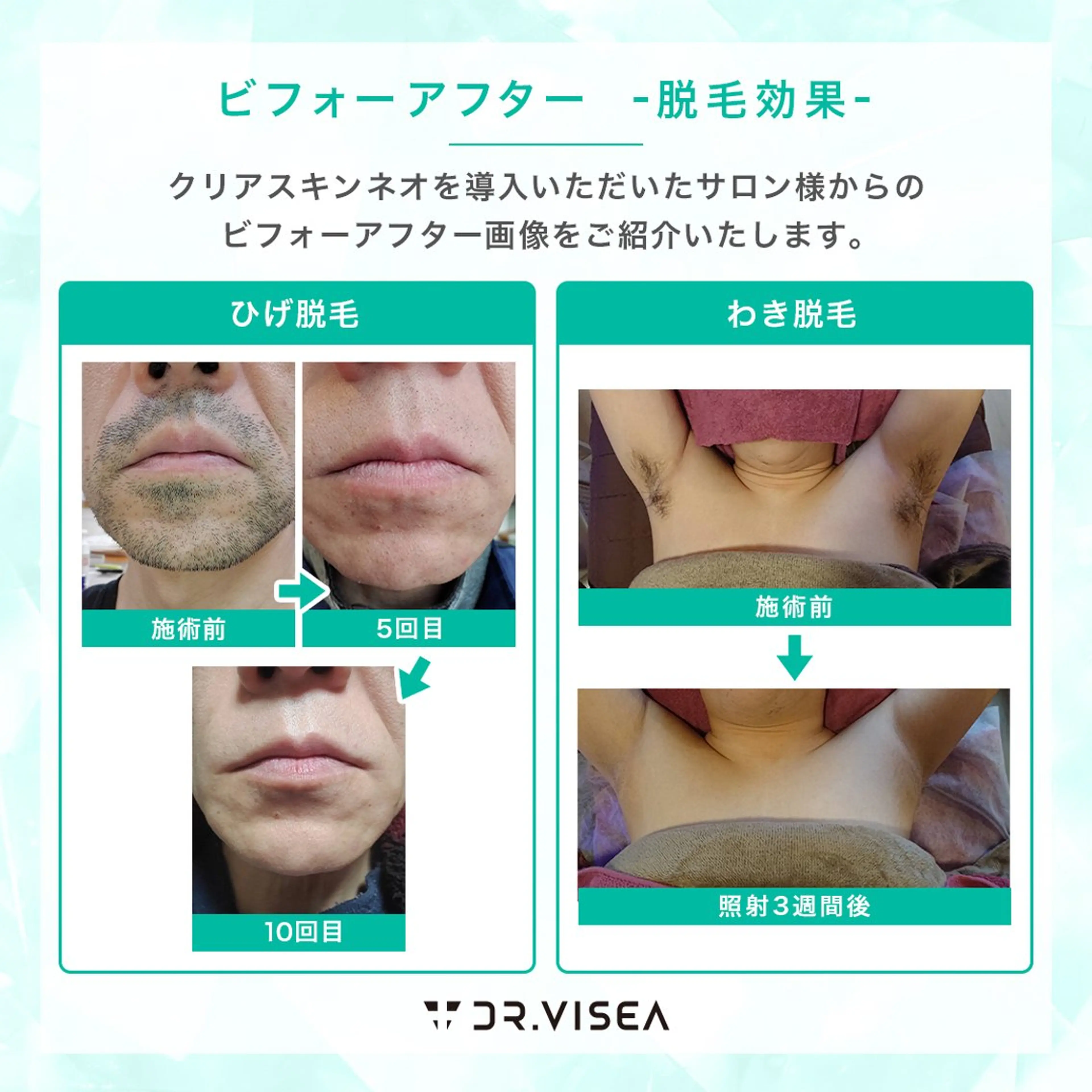 プライベートサロン Avenirのエステ・リラクイメージ