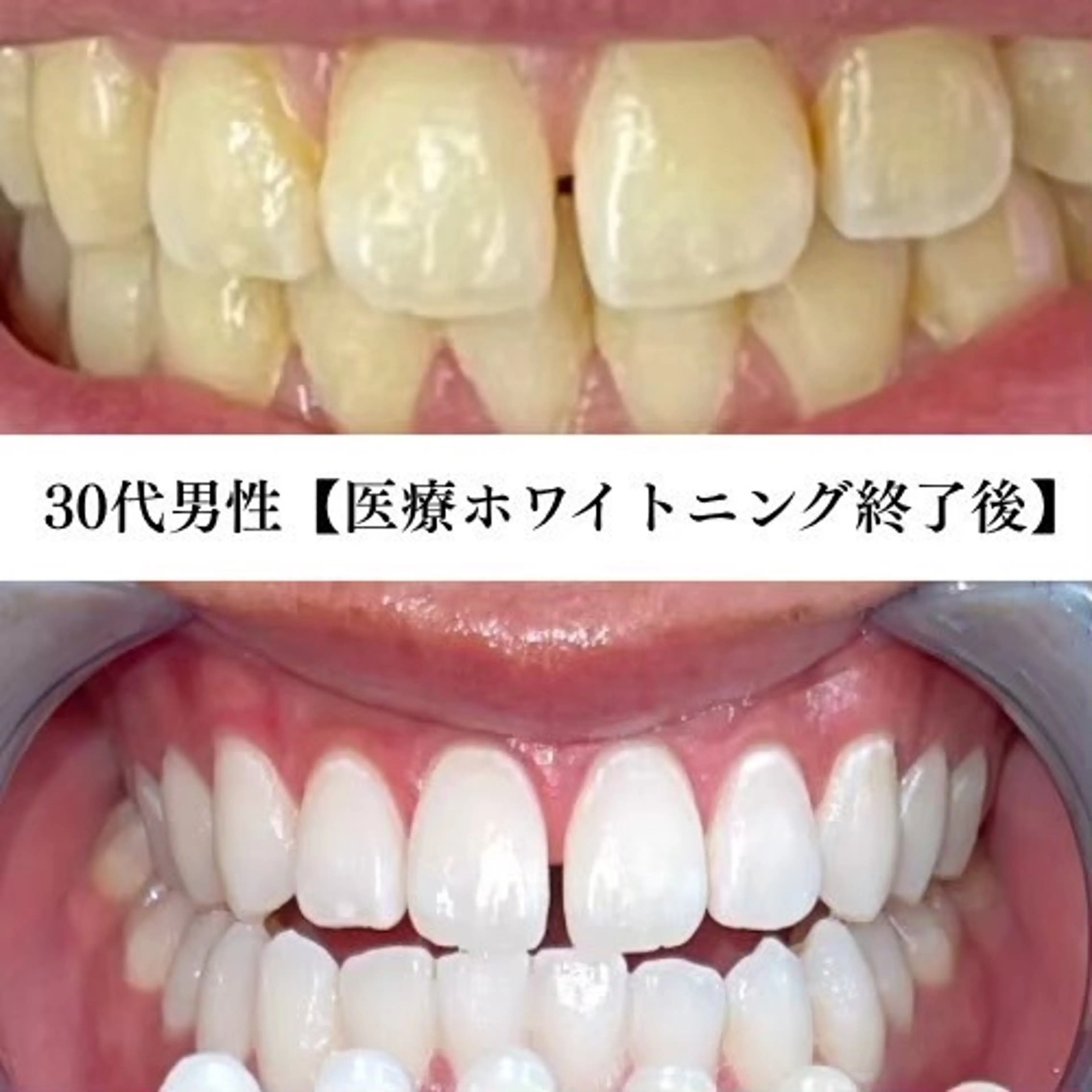 キッズ メンズ エステ リラク ホワイトニングサロン WHITE福岡博多店のエステ・リラクイメージ