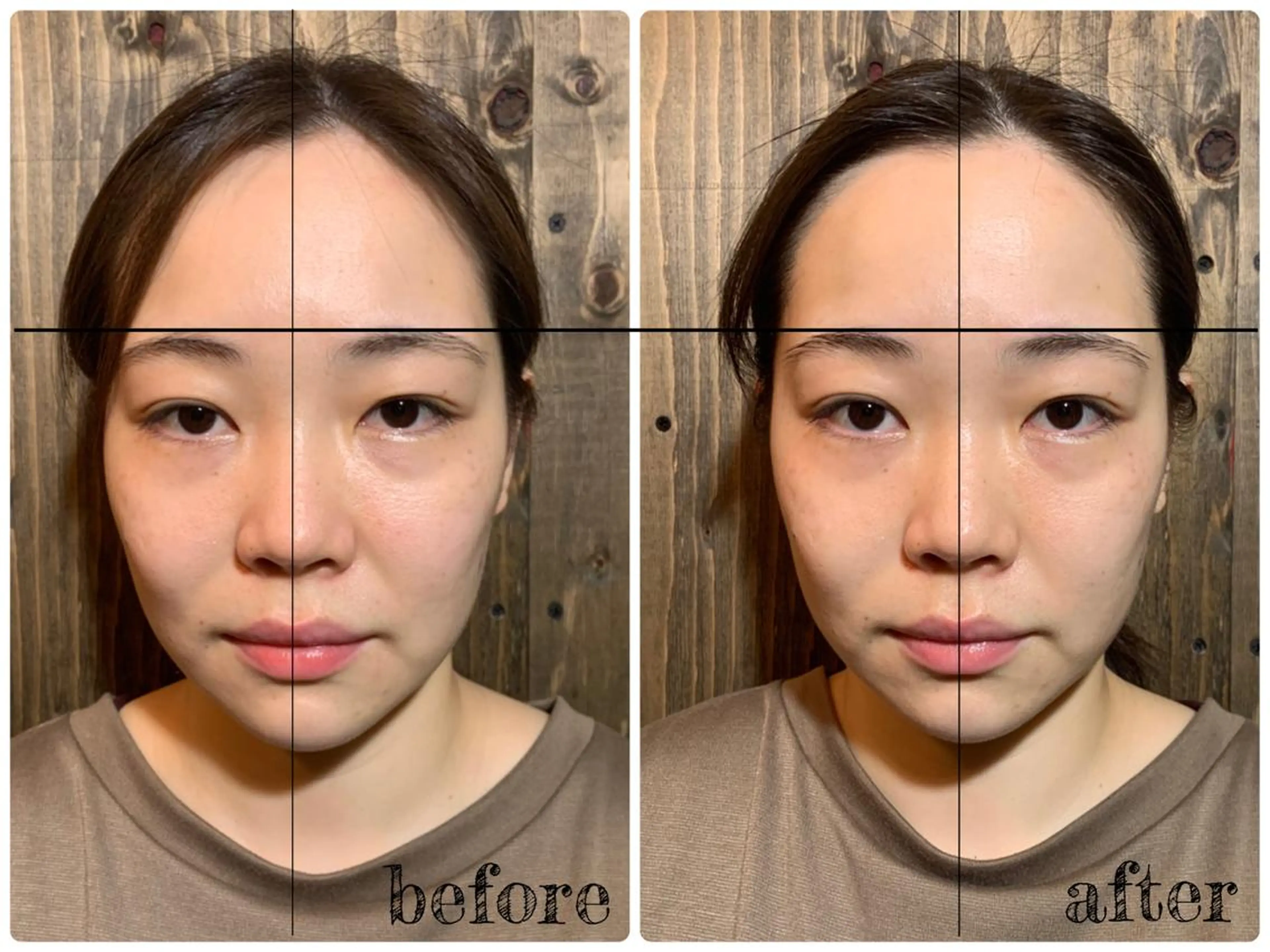 エステ リラク 💎後悔させない小顔 矯正💎イトヤマ🌱のエステ・リラクイメージ