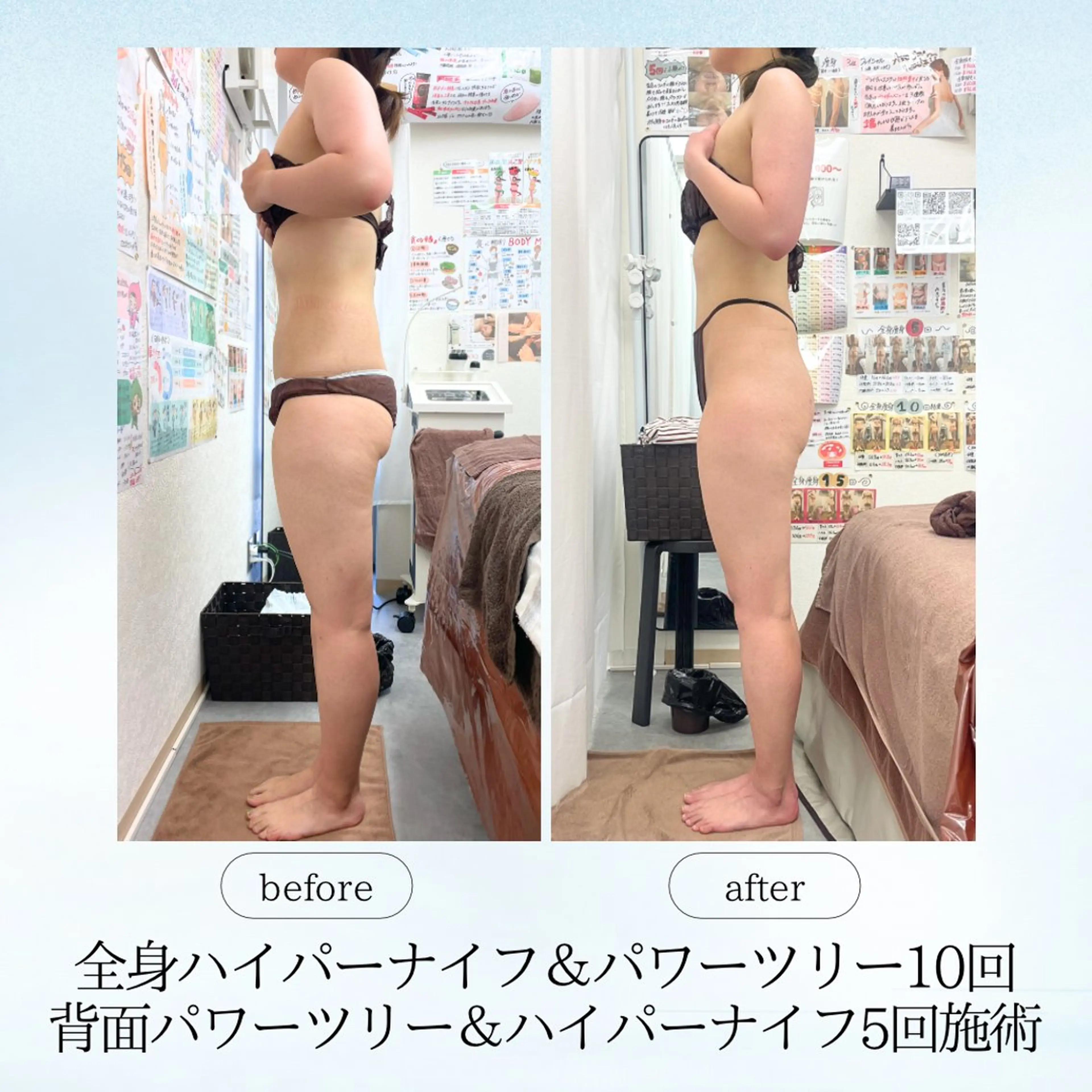 エステ リラク espresso,所属・《痩身、小顔専門店》 エスプレッソのエステ・リラクイメージ