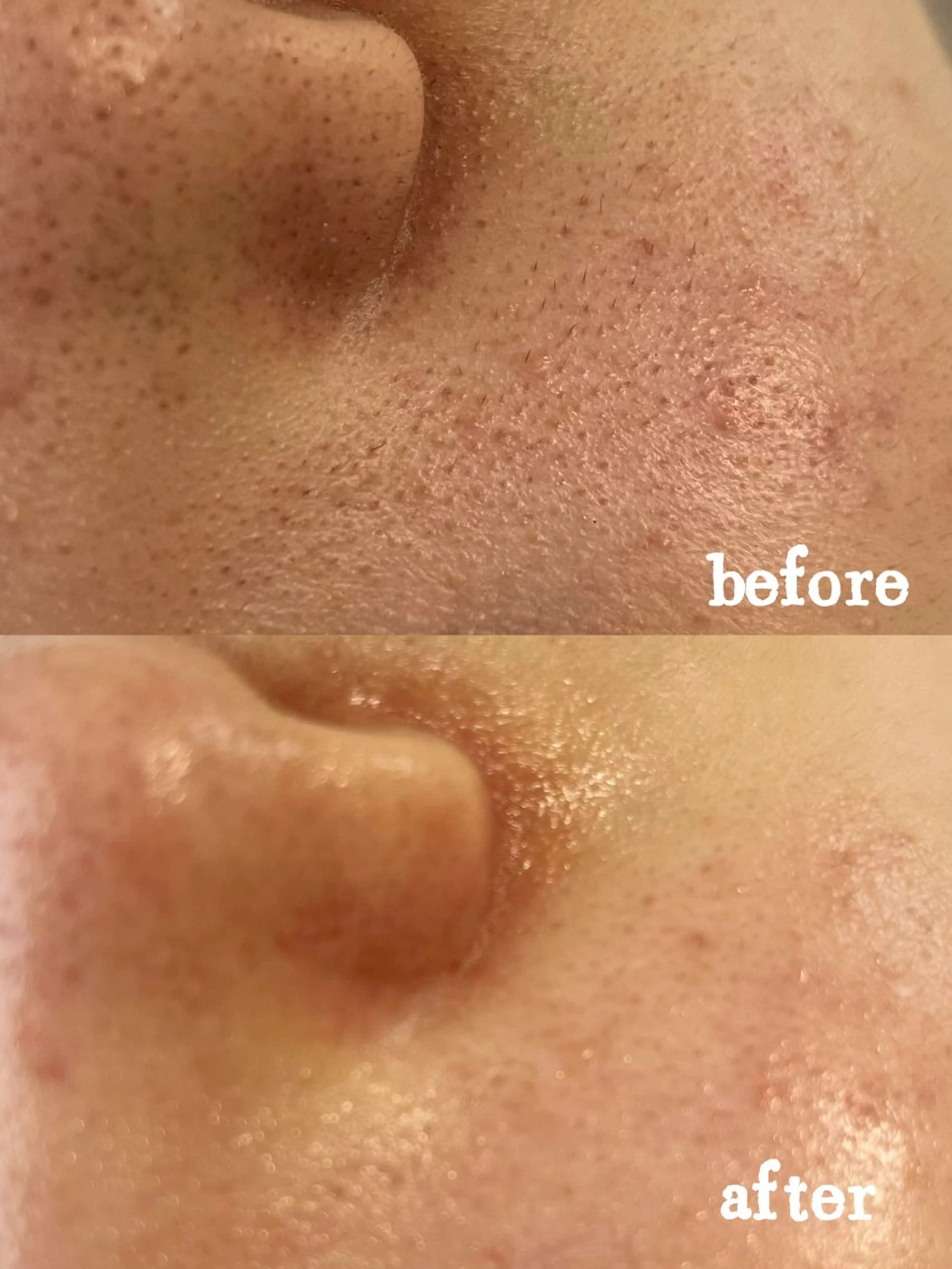 Nature Souce毛穴専門店のその他イメージ