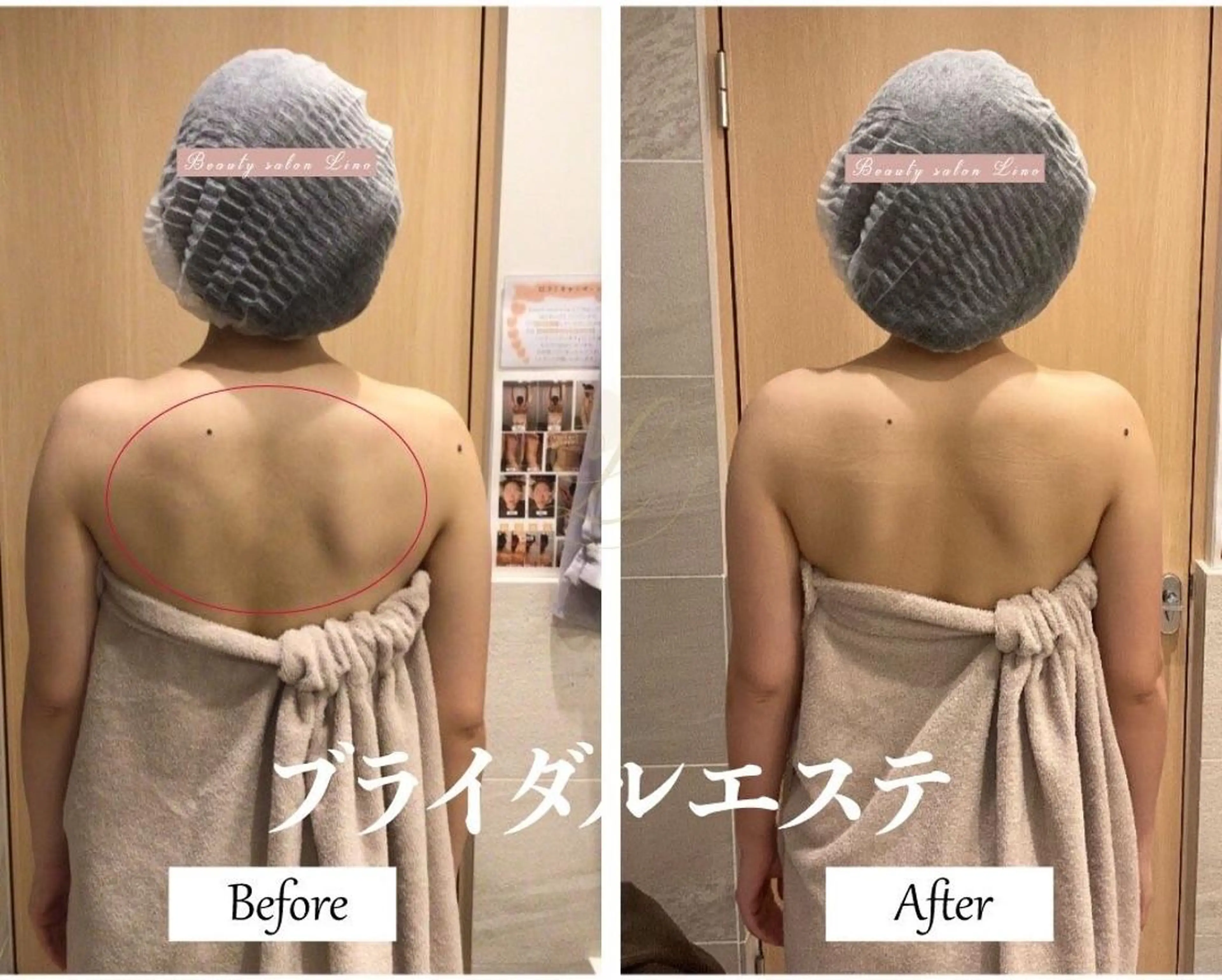 ブライダルサロン ｜Lino【堀江】のエステ・リラクイメージ