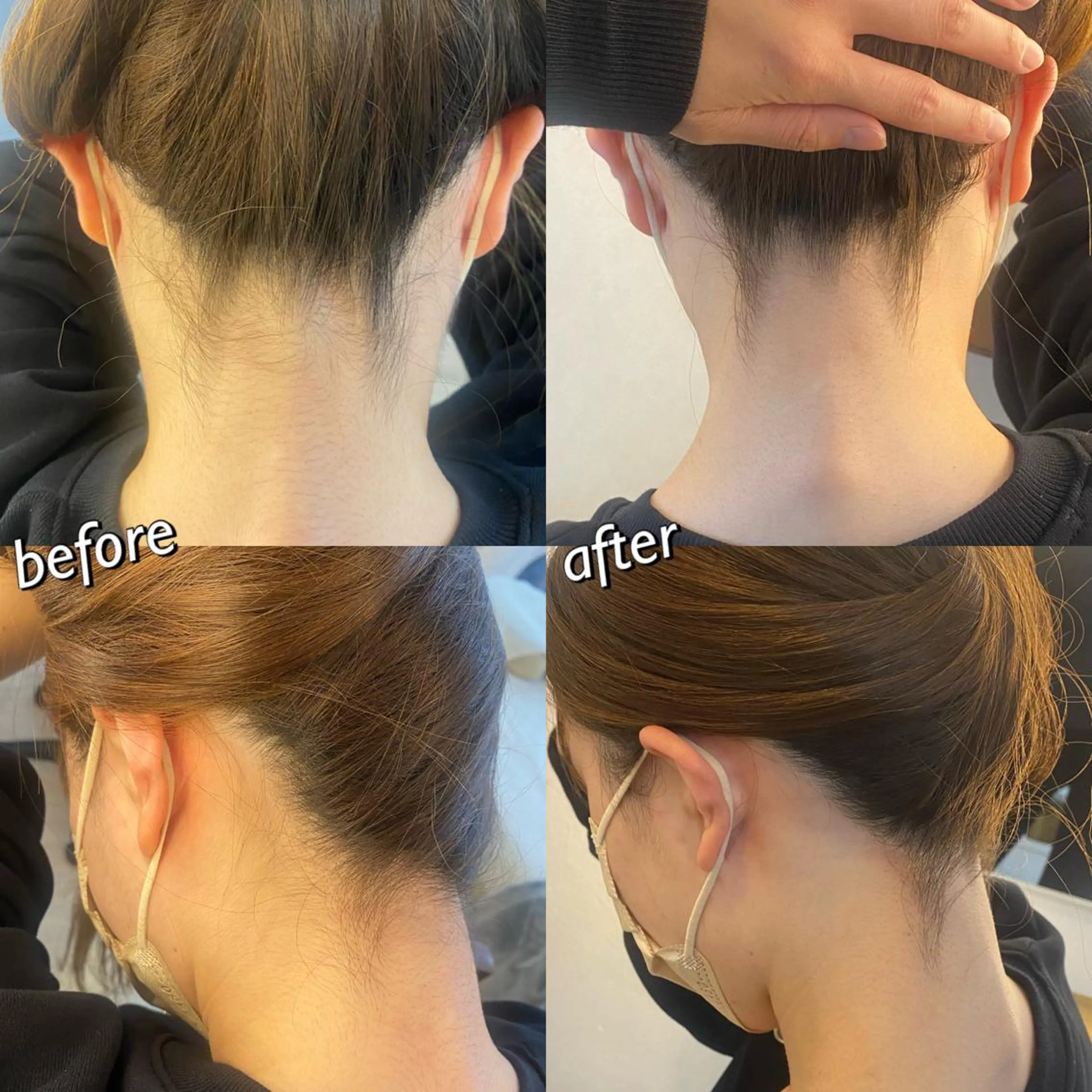 うなじ脱毛/美肌脱毛 LABELのエステ・リラクイメージ