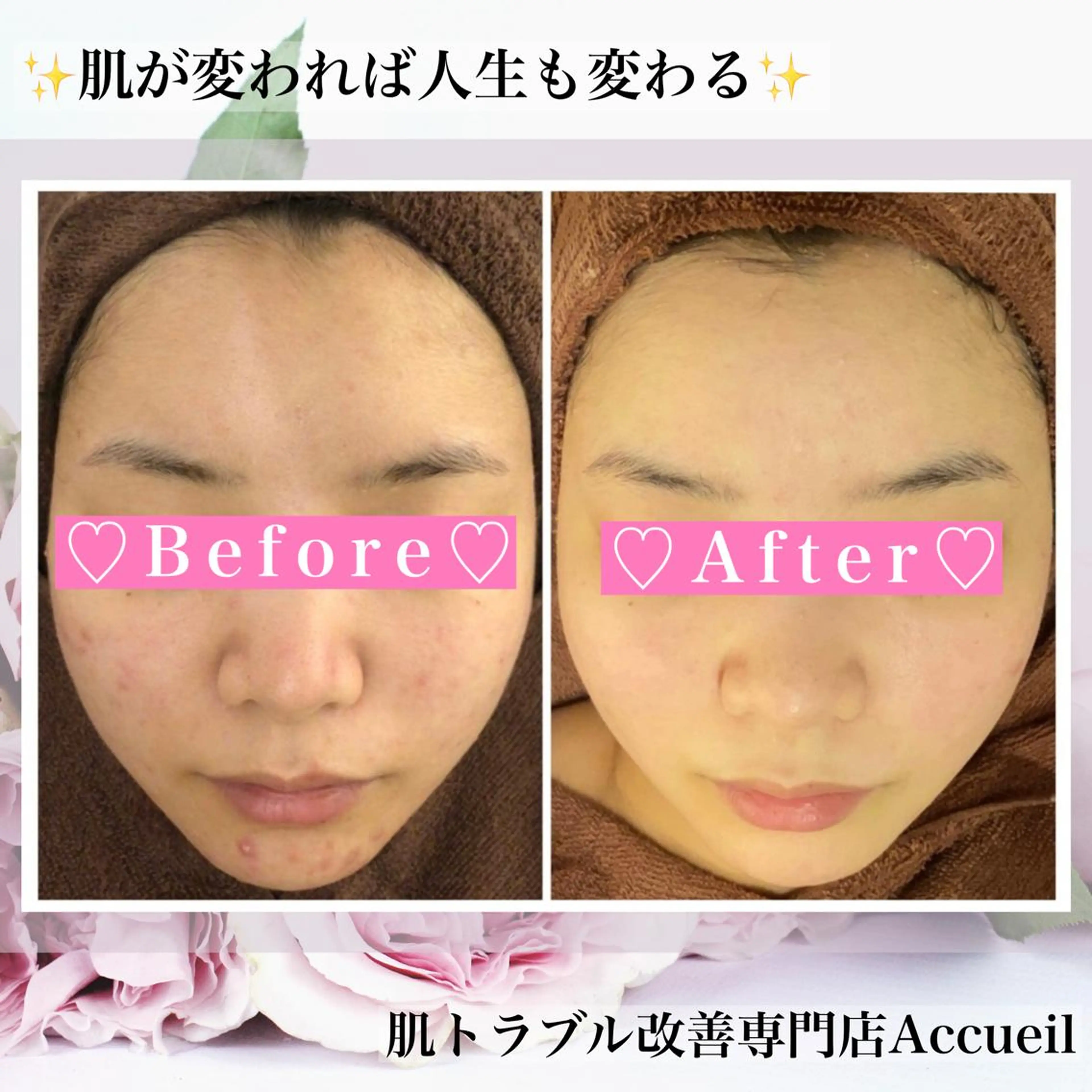 ミディアム カラー パーマ ヘアアレンジ メンズ キッズ ネイル マツエク・マツパ アイブロウ ニキビ・肌質改善専門 ♡人生が変わるサロンのエステ・リラクイメージ