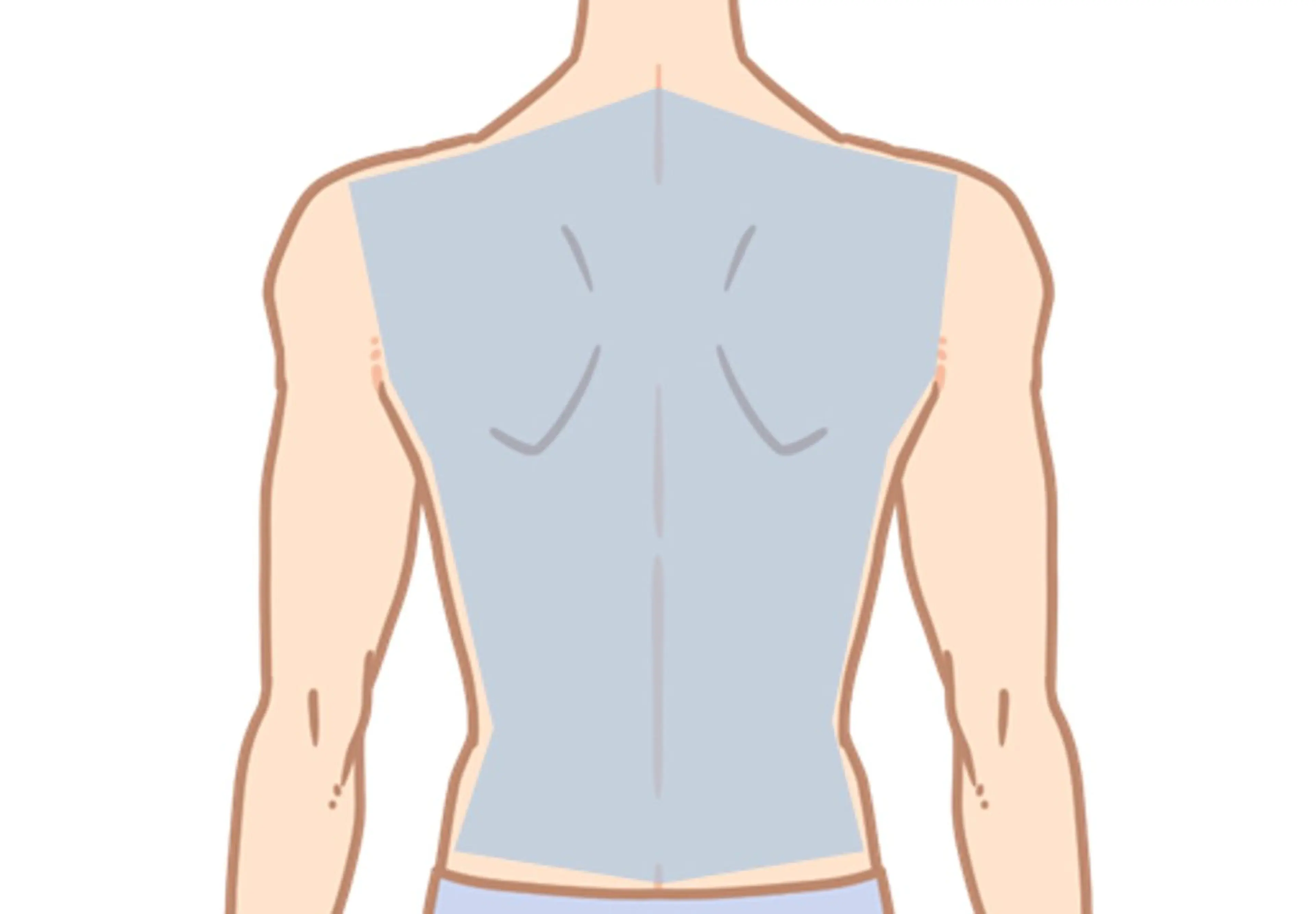 【背中】脱毛の写真