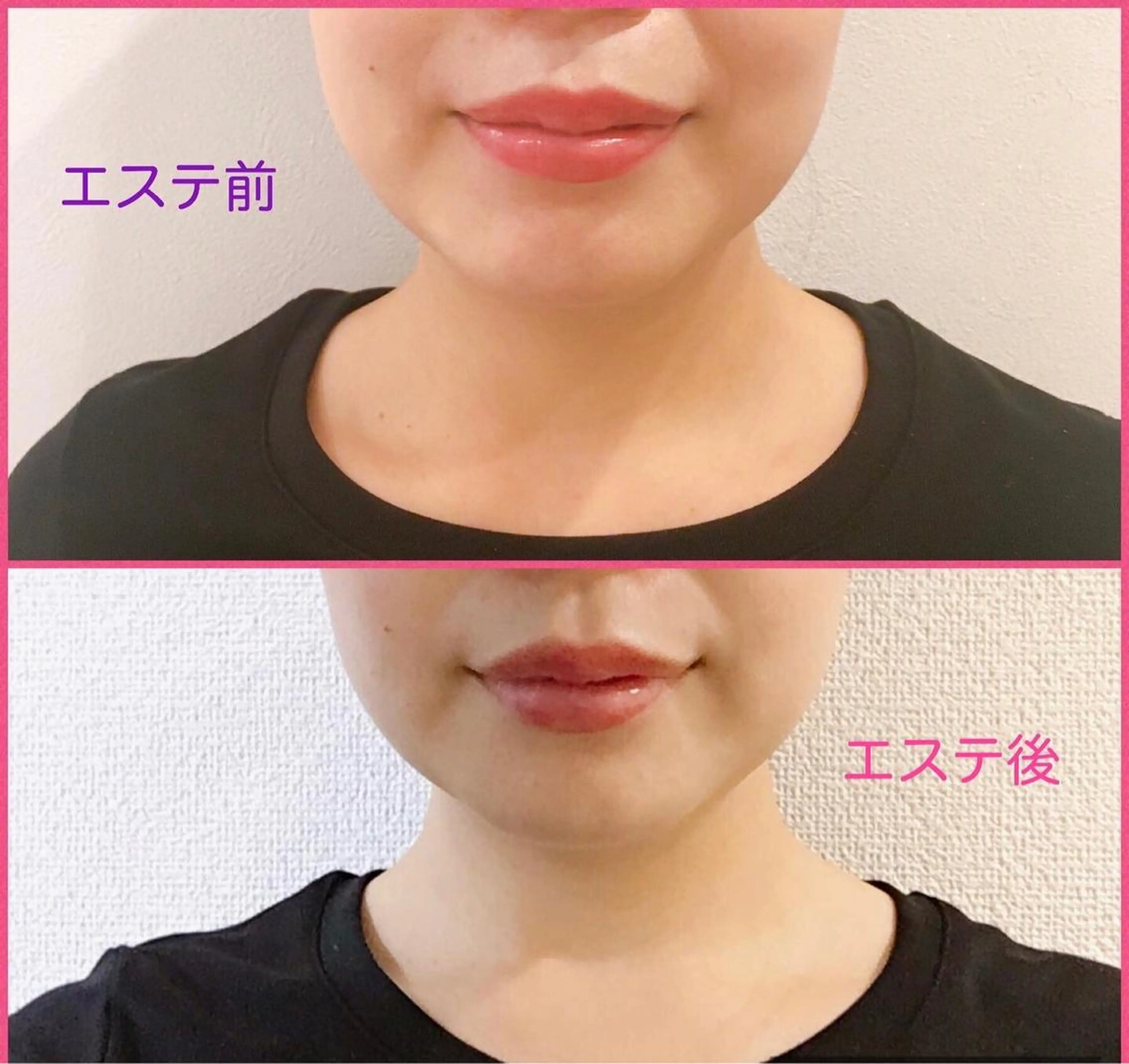 POLA Miu岸辺店所属・POLA　Miu岸辺 のざきのエステ・リラクイメージ