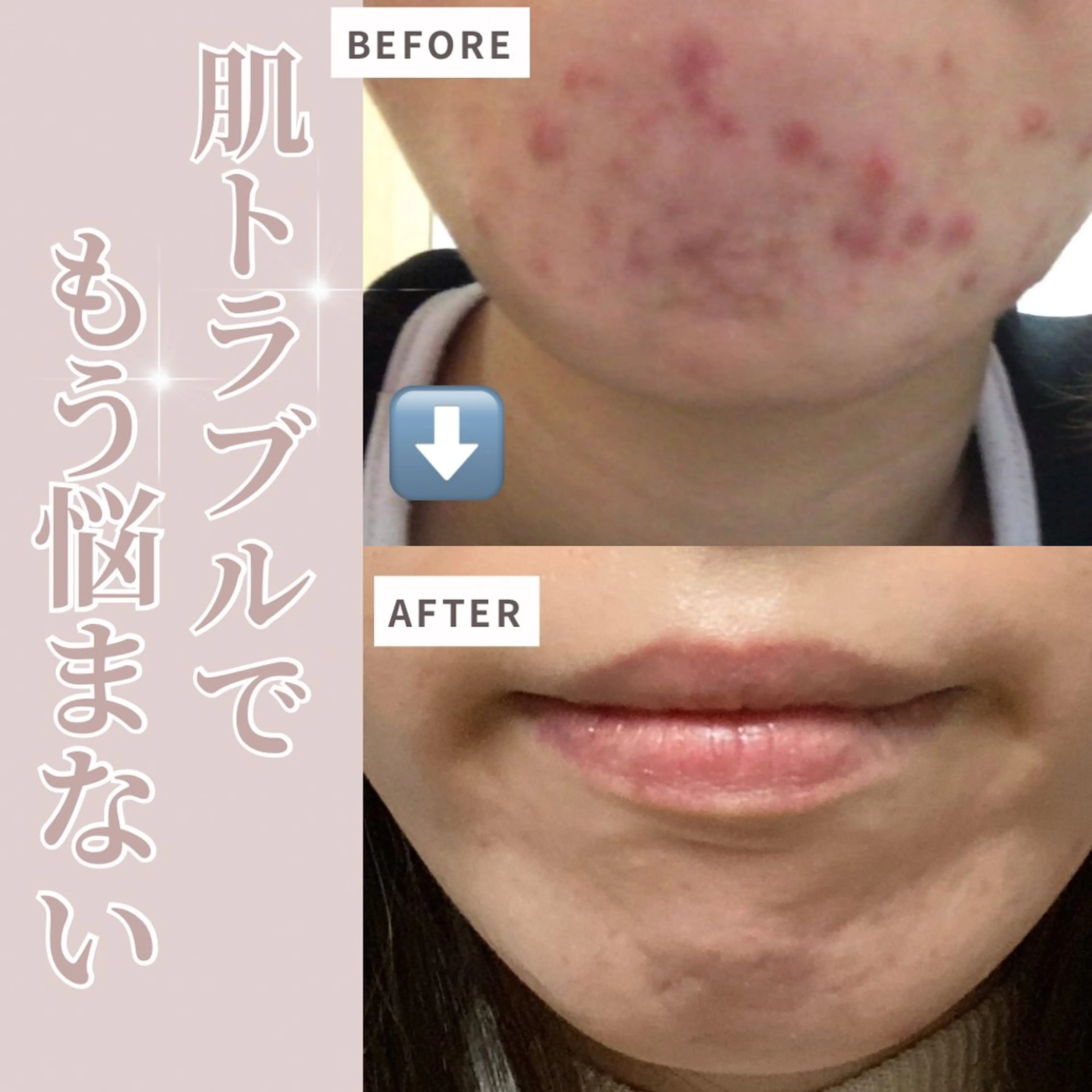 《夜専用🌙オーダーメイドフェイシャル +ヘッドorフットマッサージ10分》の写真