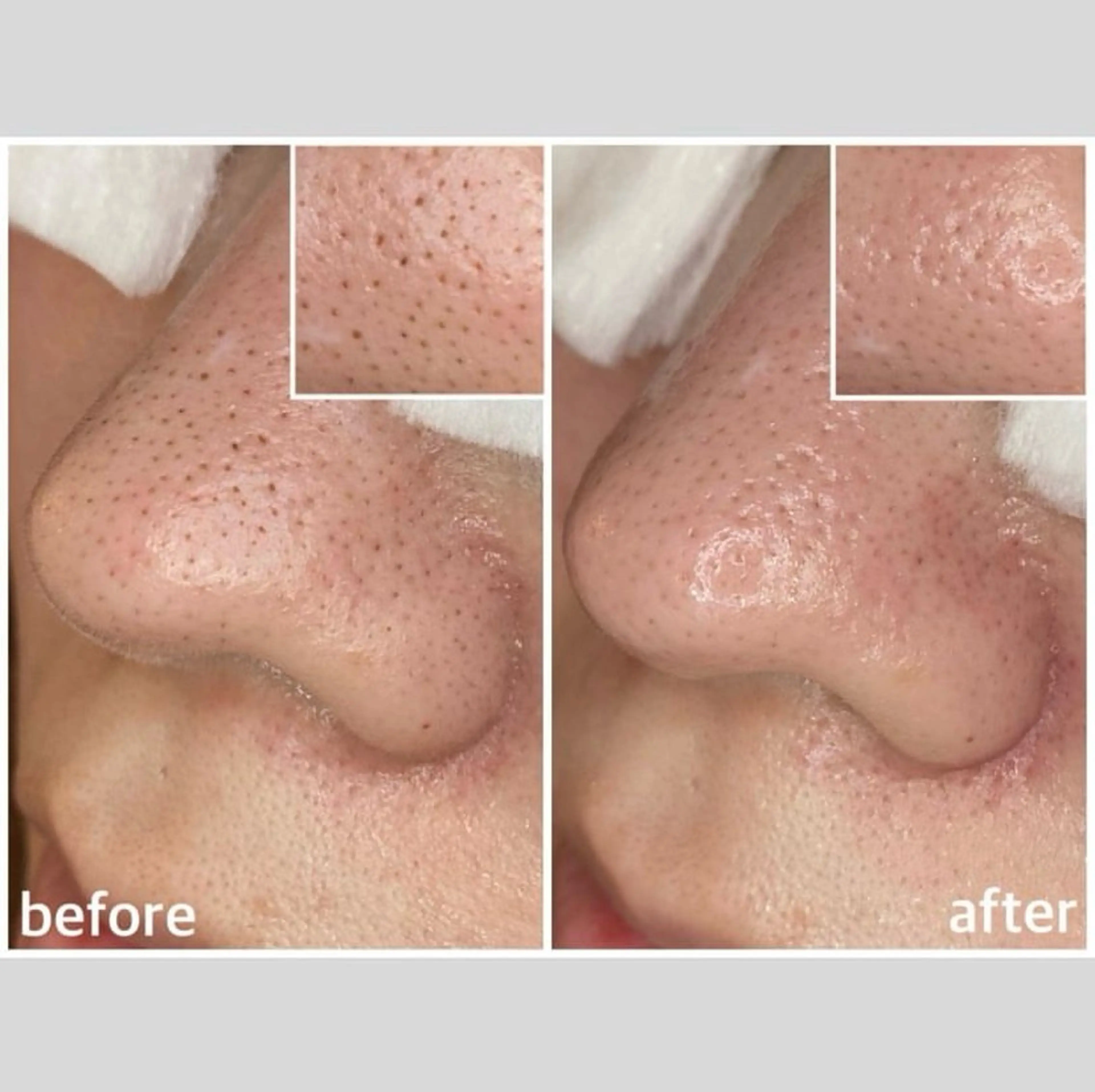 エステ リラク 韓国肌管理 【毛穴専科】のエステ・リラクイメージ