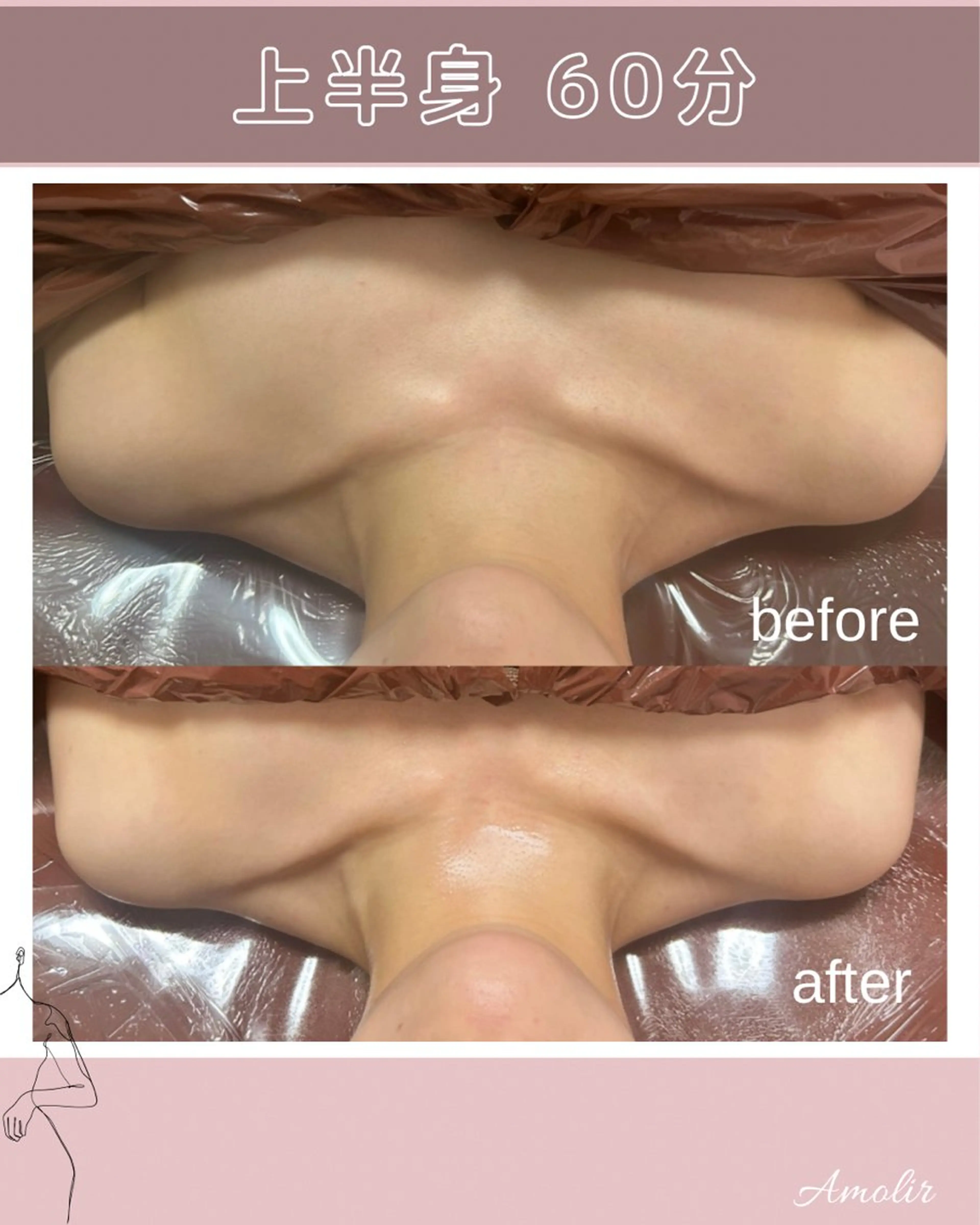 デコルテ,首肩周り,ヘッドスパ 60分の写真