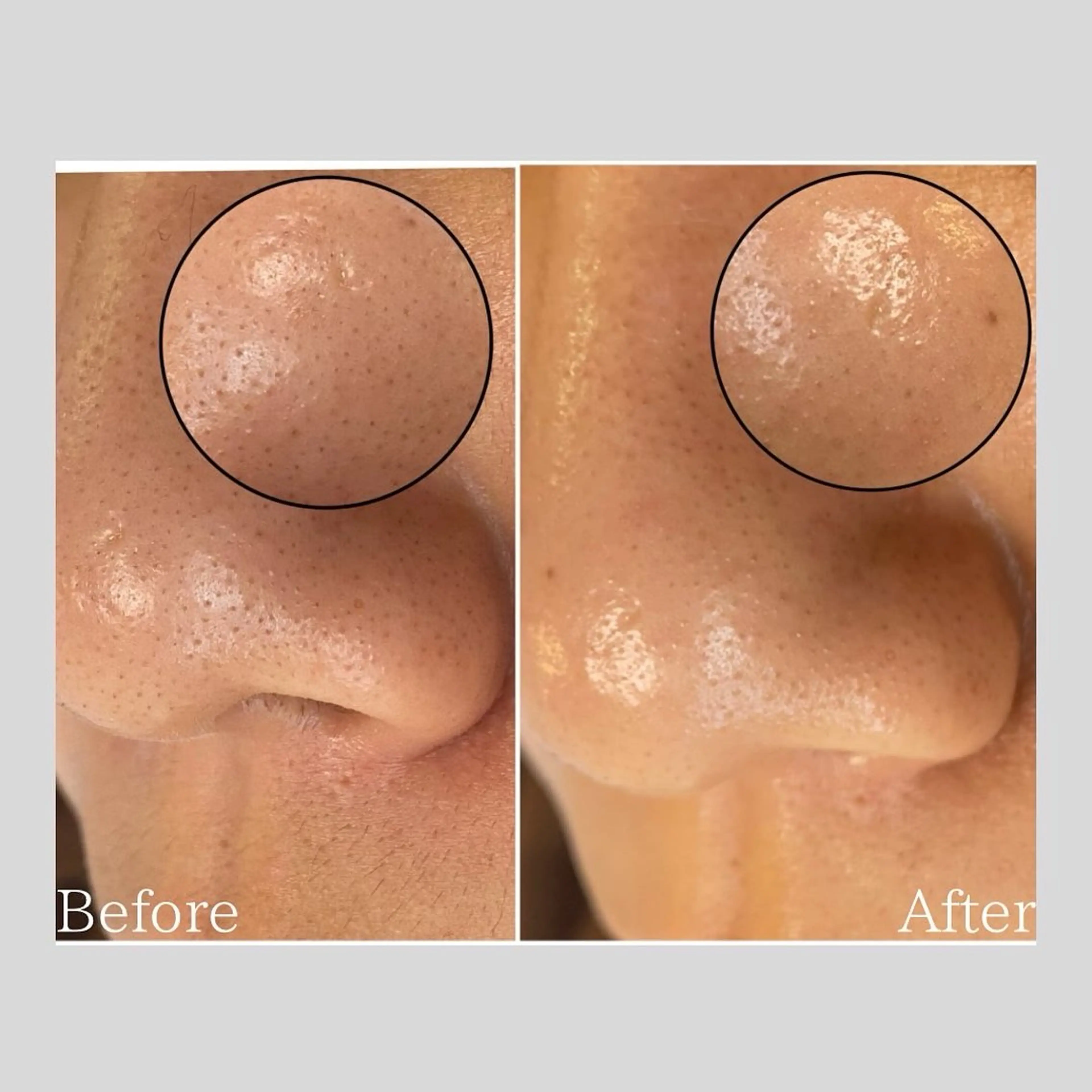 エステ リラク 韓国肌管理 【毛穴専科】のエステ・リラクイメージ